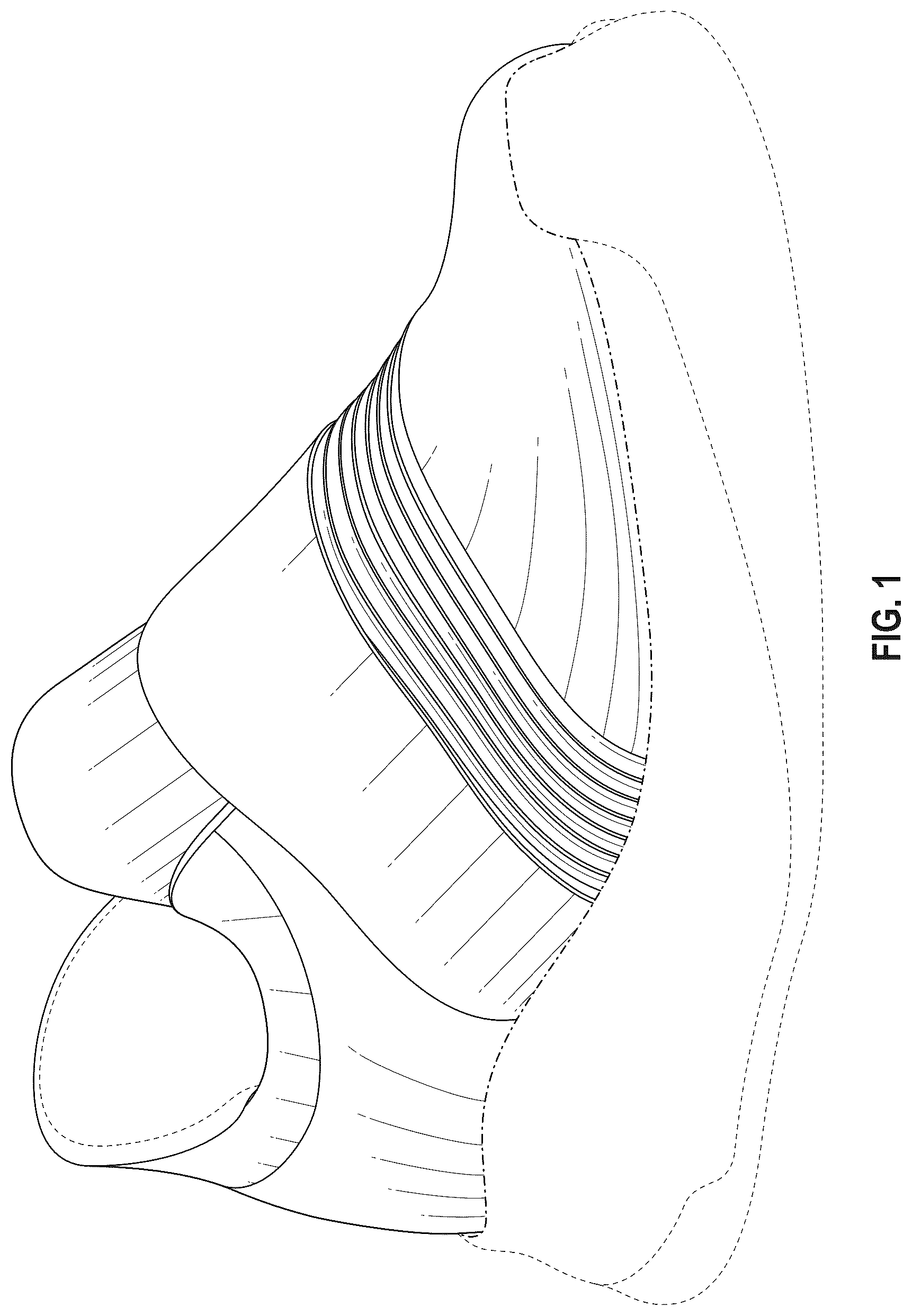 Patent USD1076394 Figure 1 – Shoe upper