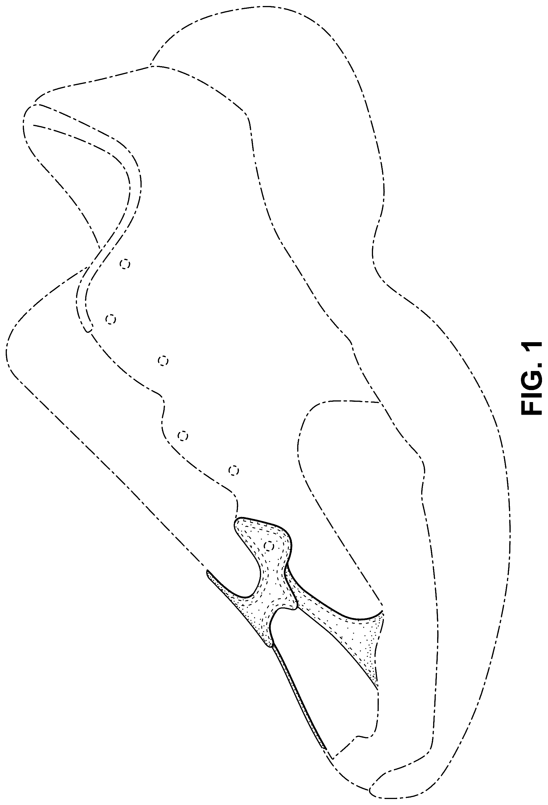 Patent USD1077450 Figure 1 – Shoe