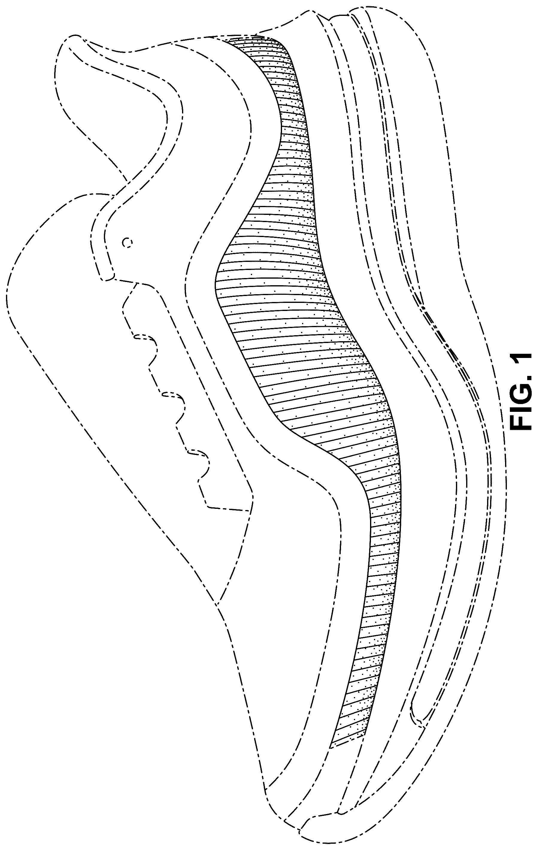 Patent USD1077451 — Shoe — Figure 1