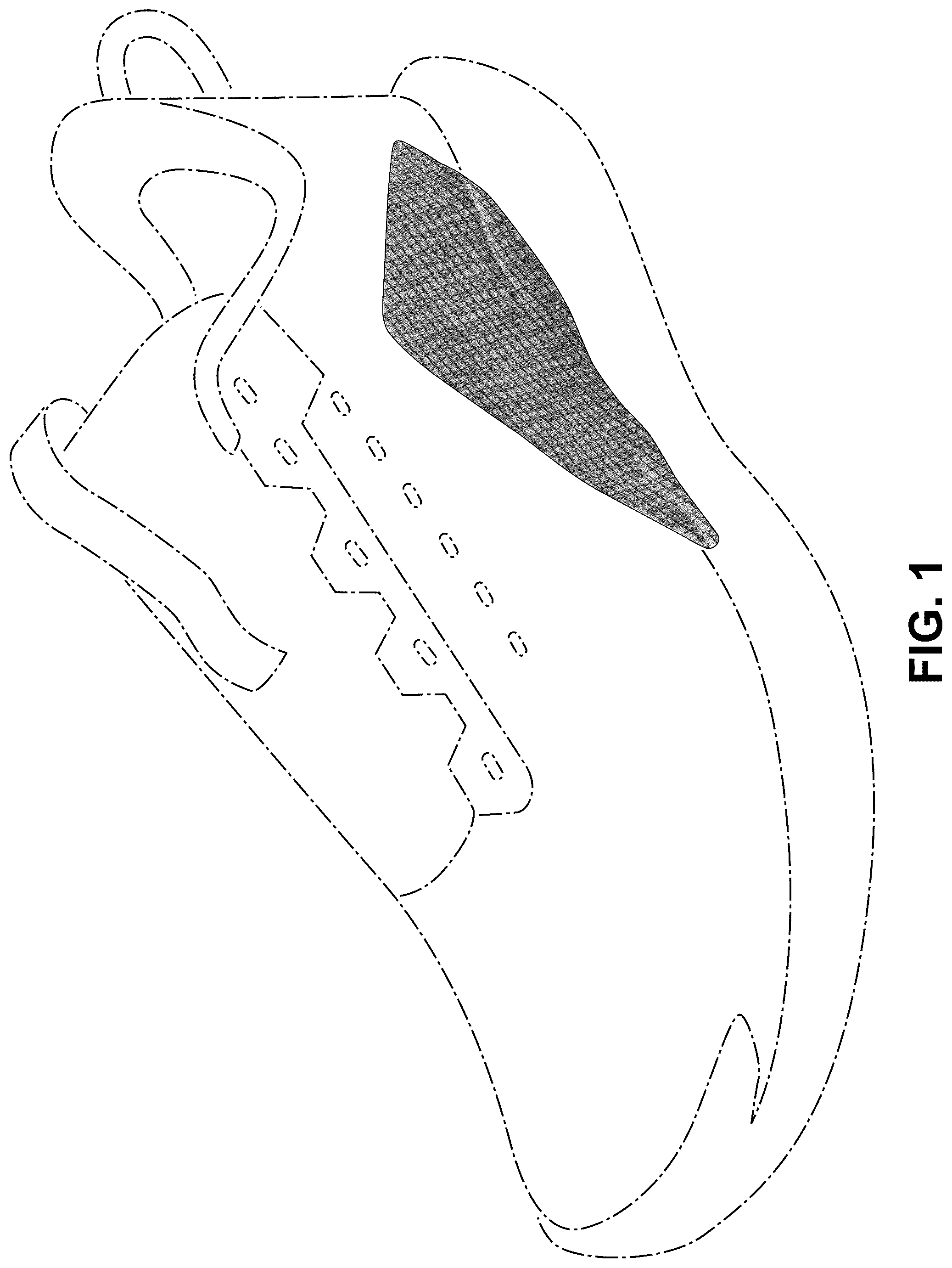 Patent USD1077454 — Shoe — Figure 1