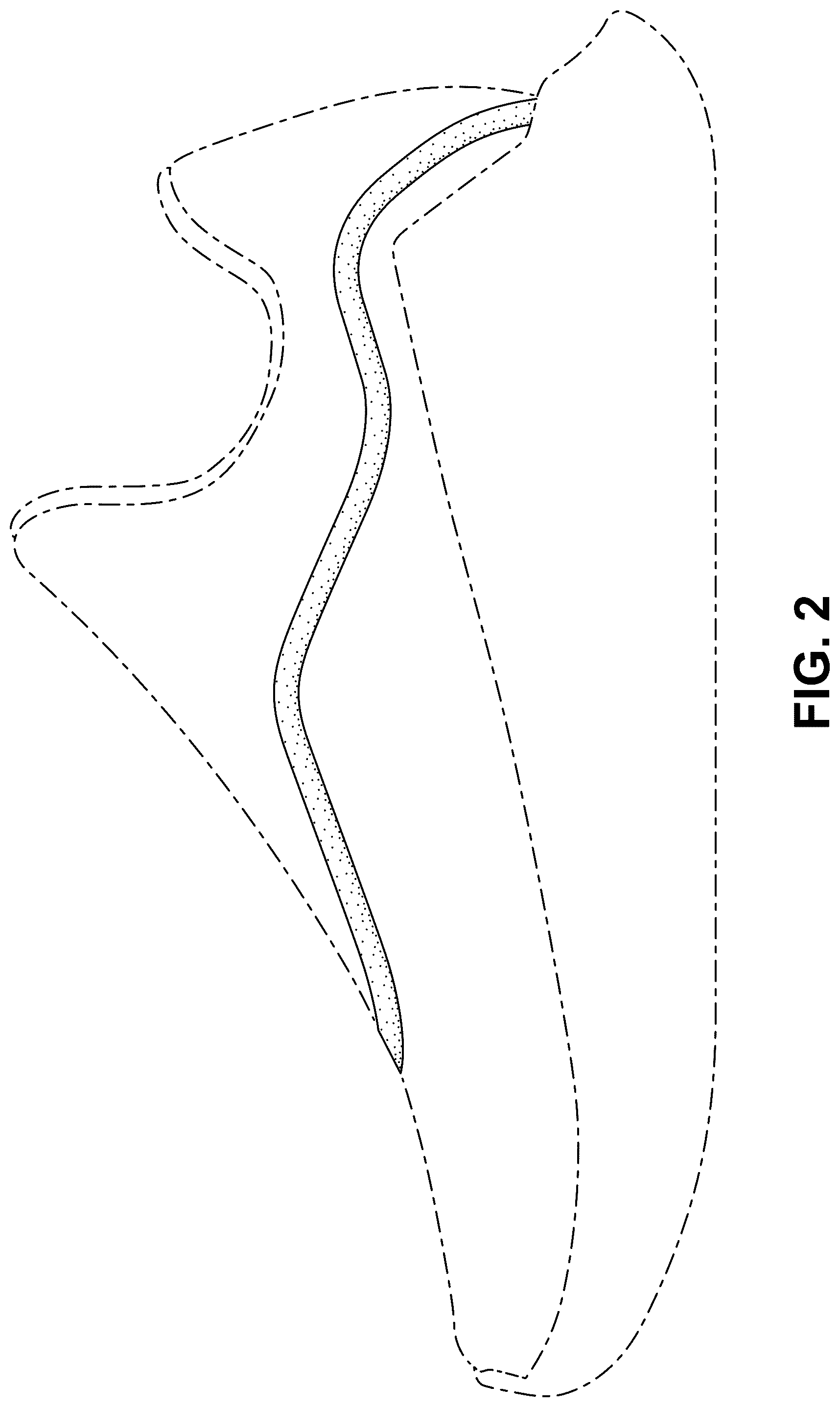 Patent USD1077456 Figure 2 – Shoe