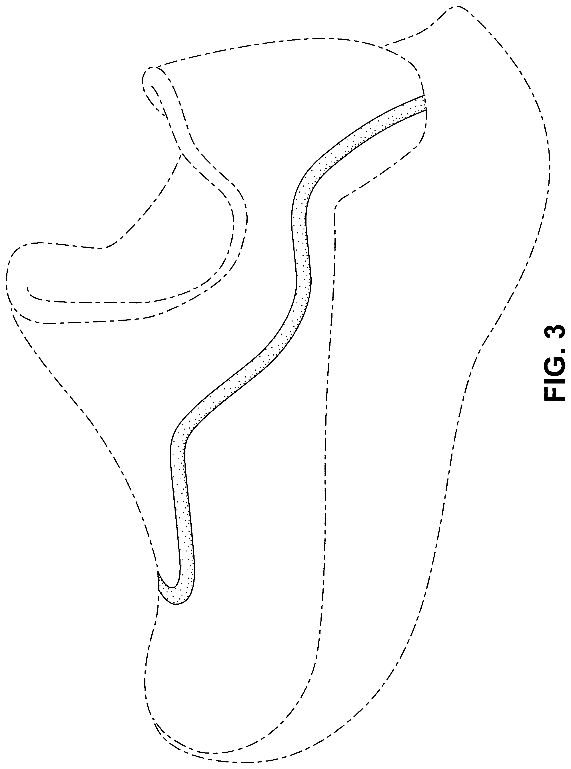 Patent USD1077456 Figure 3 – Shoe