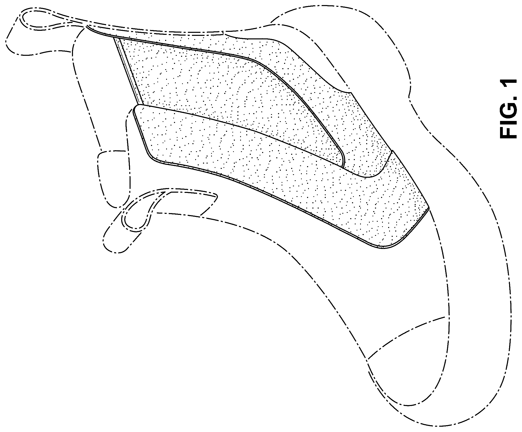 Patent USD1078254 Figure 1 – Shoe