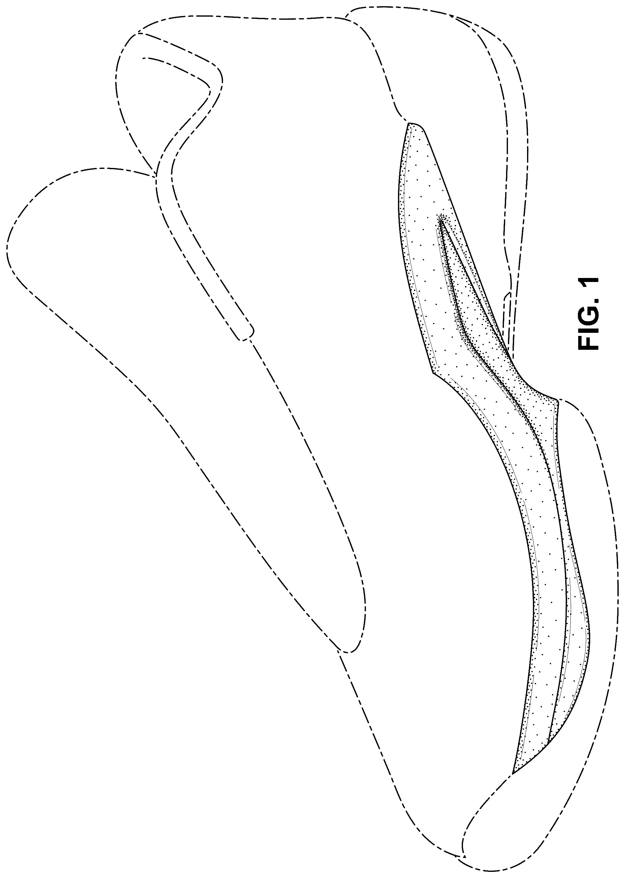 Patent USD1100454 Figure 1 – Shoe