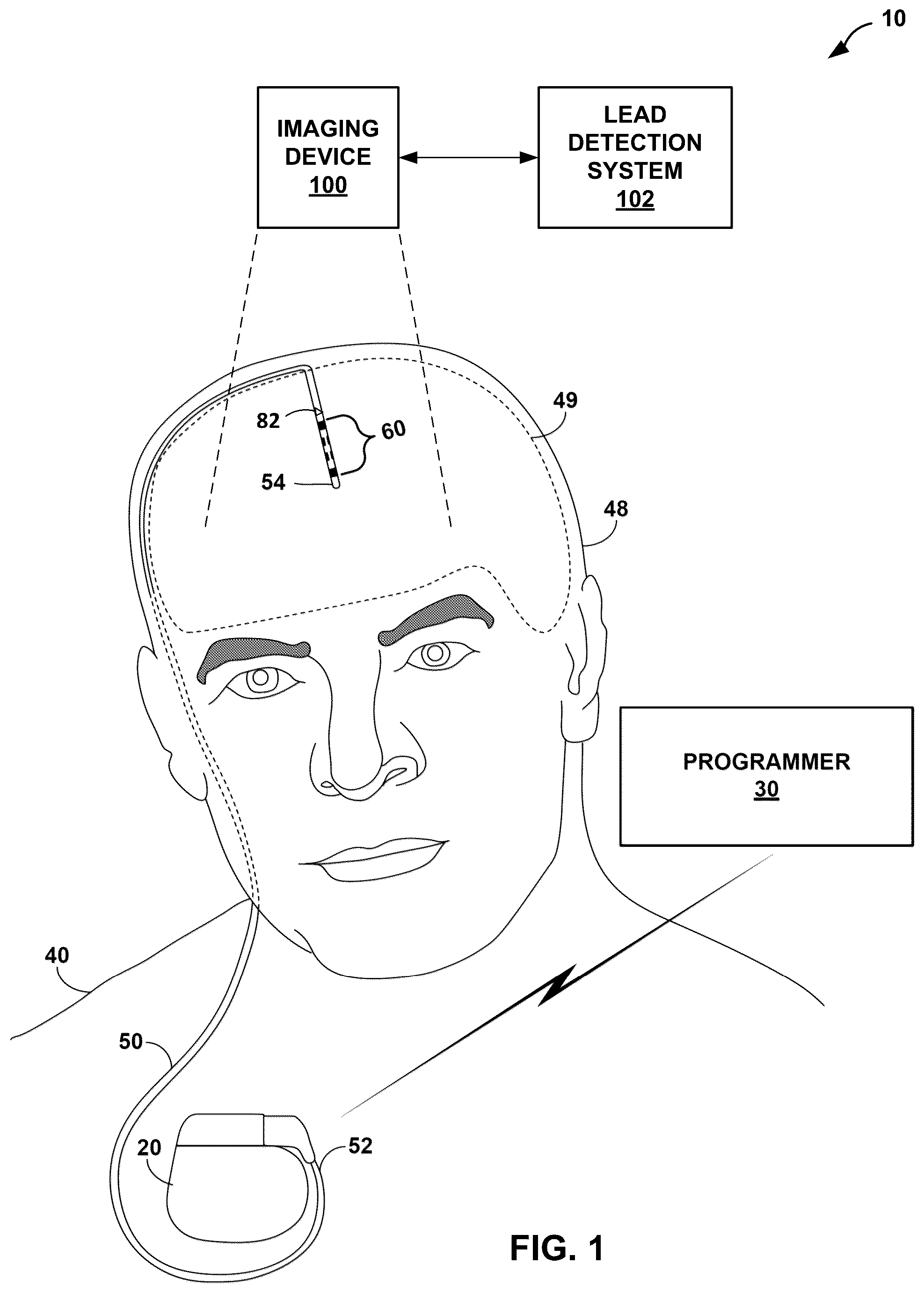 Patent US12541874 Figure 1 – Lead orientation determination for electrical stimulation therapy