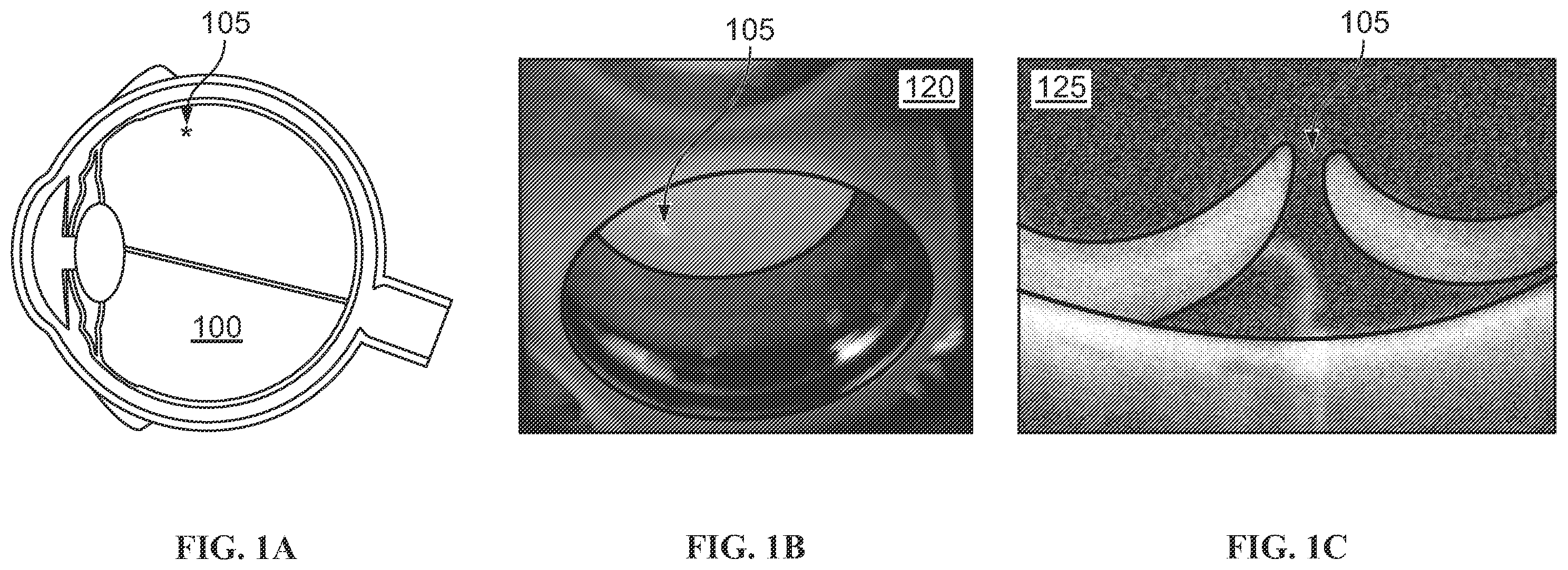 Patent US12551102 — Systems and methods for peripheral retinal optical coherence tomography — Figure 1