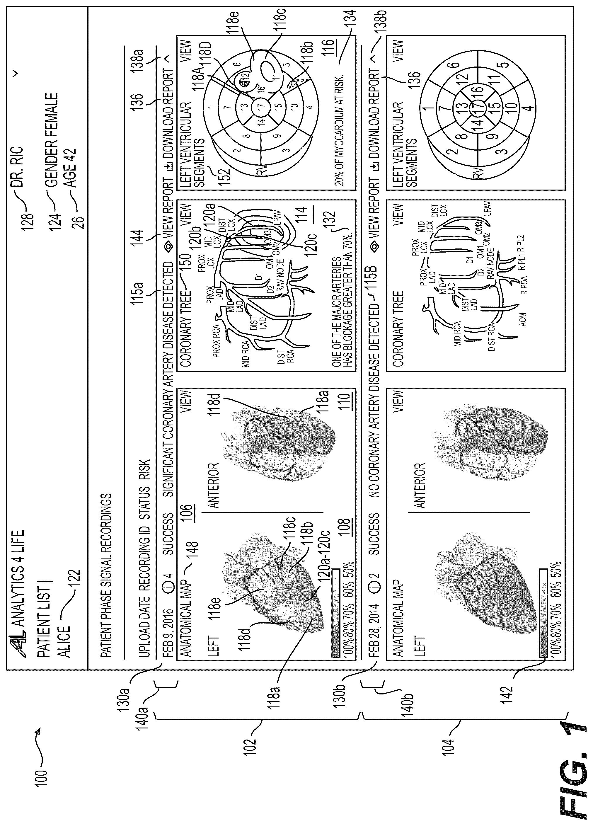 Patent US12551112 — Method and system for visualization of heart tissue at risk — Figure 1