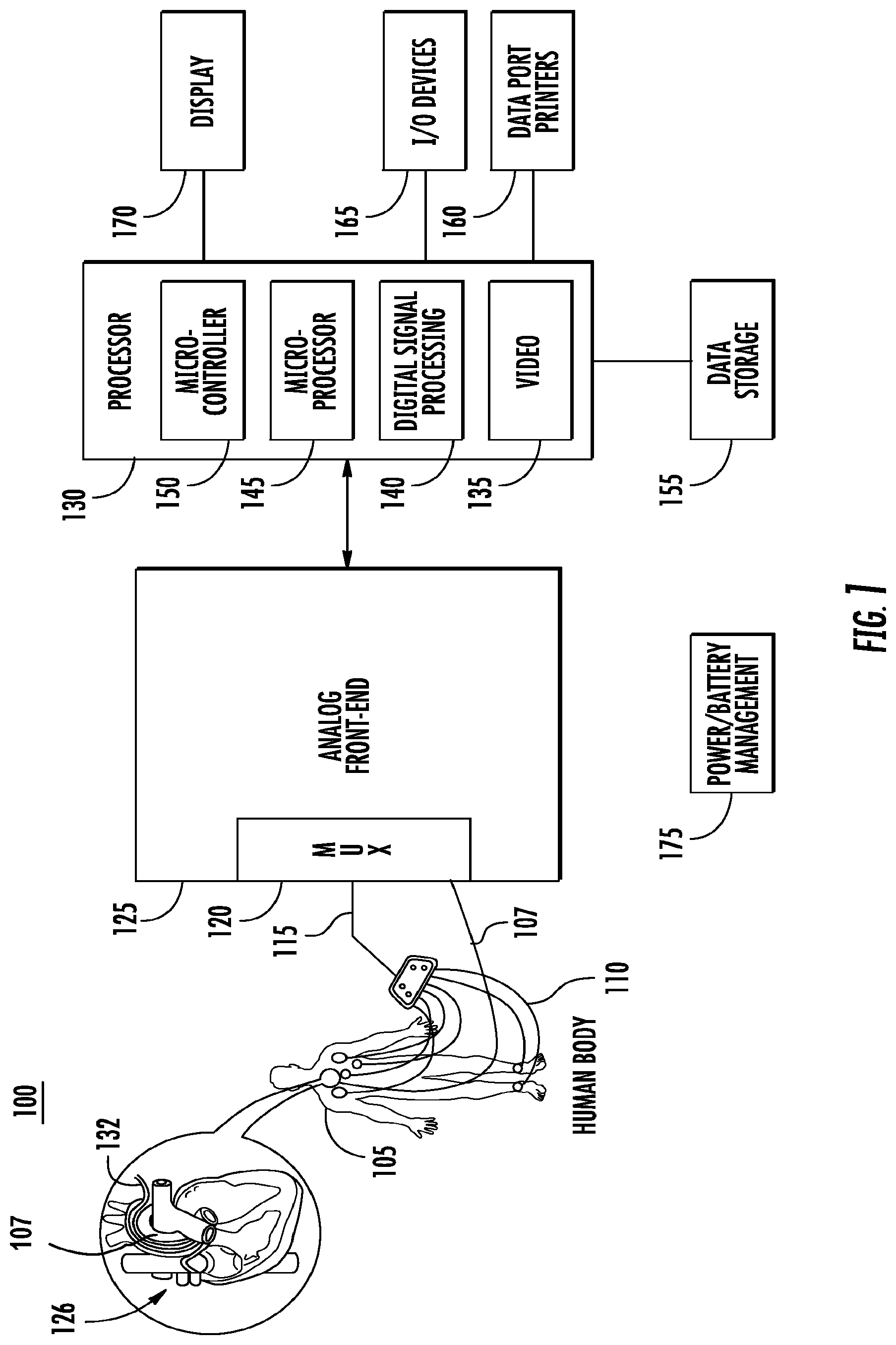 Patent US12551127 — Impedance measurements using burst pulses to prevent noise on ECG — Figure 1