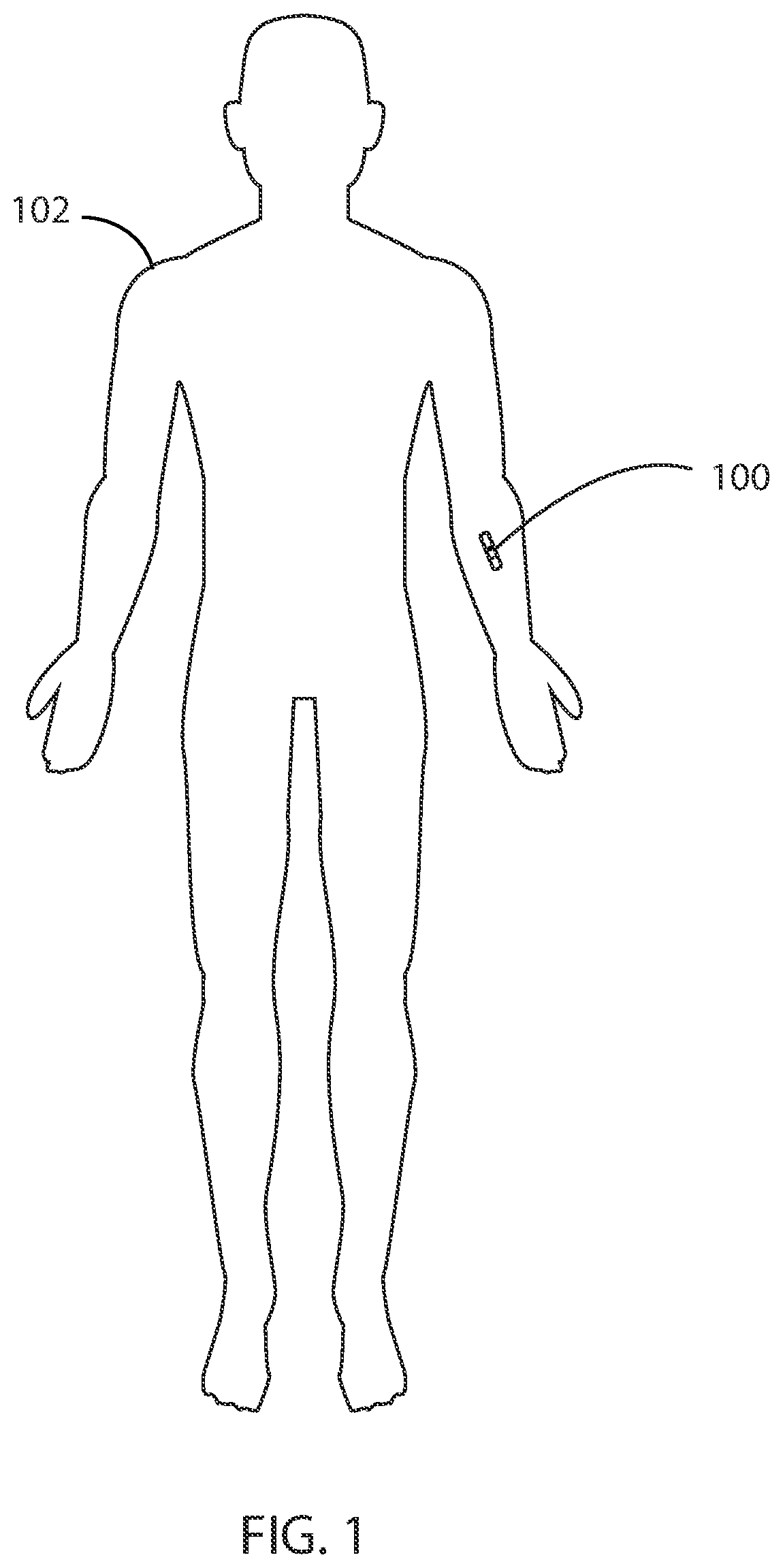 Patent US12551145 — Integrated thermo-photonic chemical sensor — Figure 1