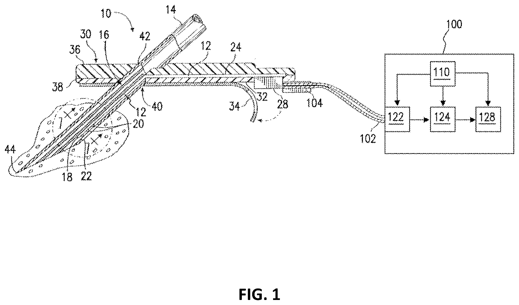Patent US12551148 — Systems and methods for compensating for agent elution — Figure 1