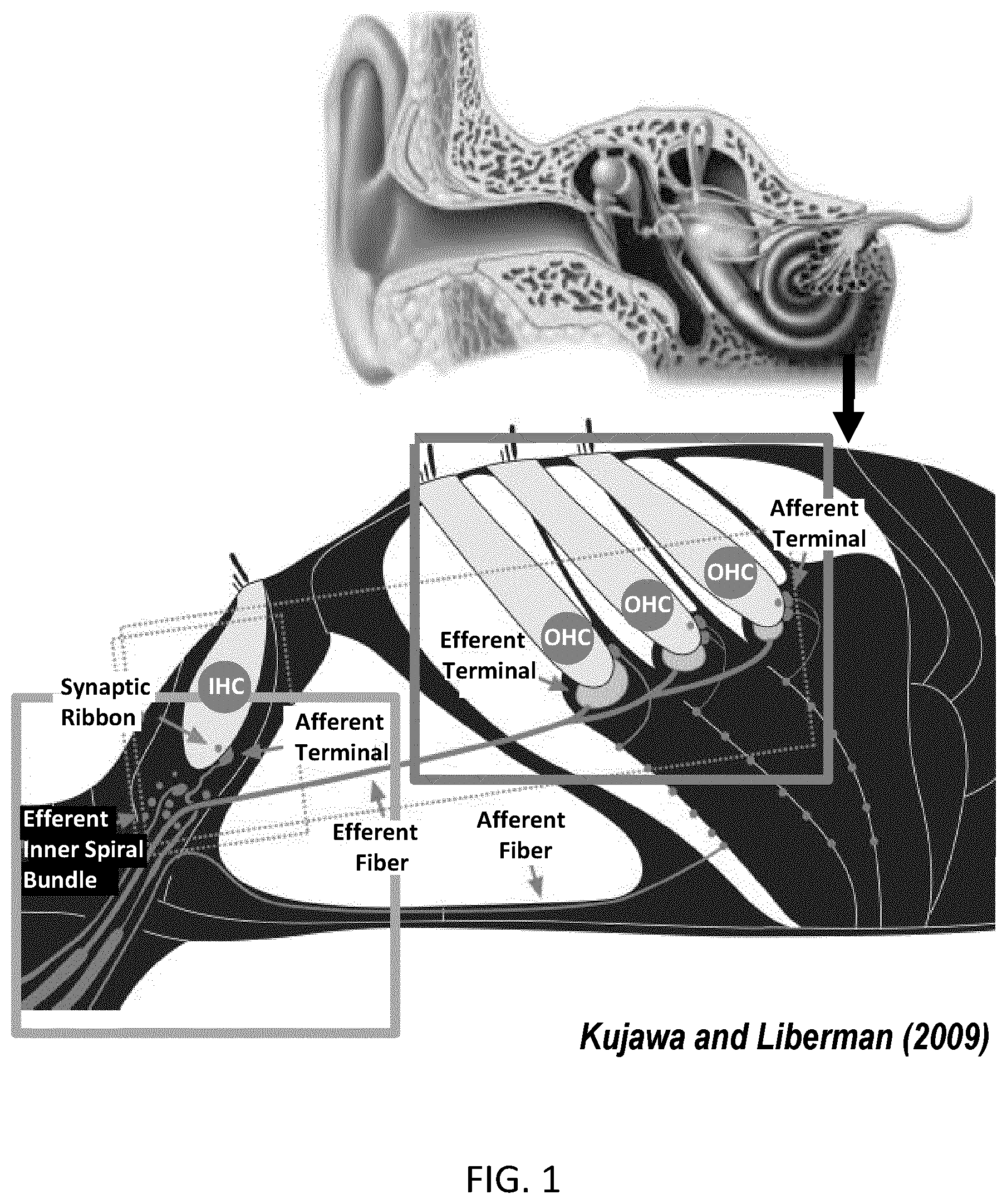 Patent US12551157 — Method and system for determining the integrity of auditory nerve fibers and synapses — Figure 1
