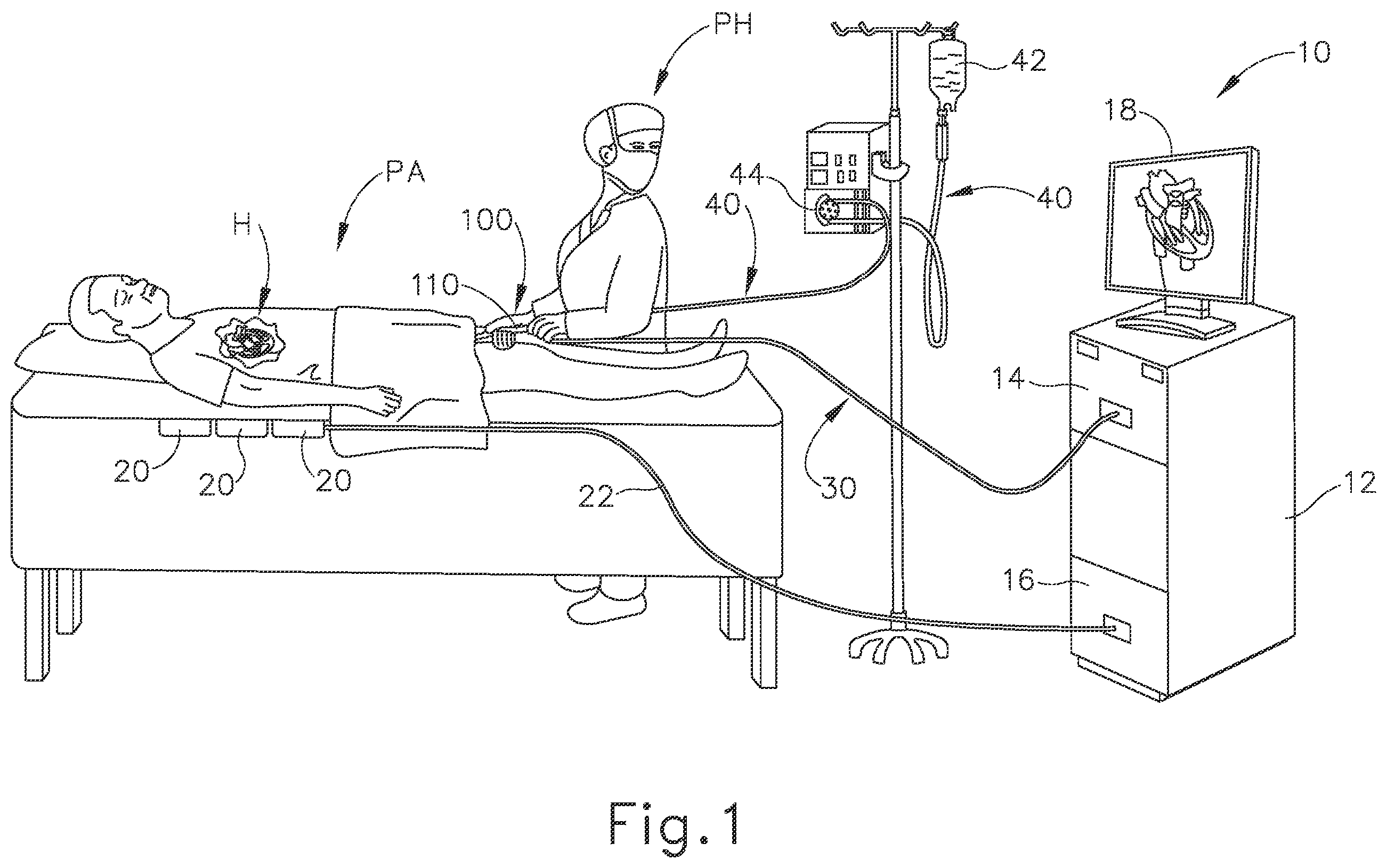 Patent US12551166 — Reference wires to remove noise and artifacts in cardiac mapping catheter — Figure 1