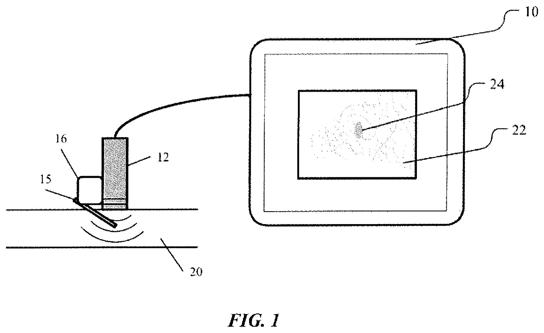 Patent US12551185 — On-screen markers for out-of-plane needle guidance — Figure 1