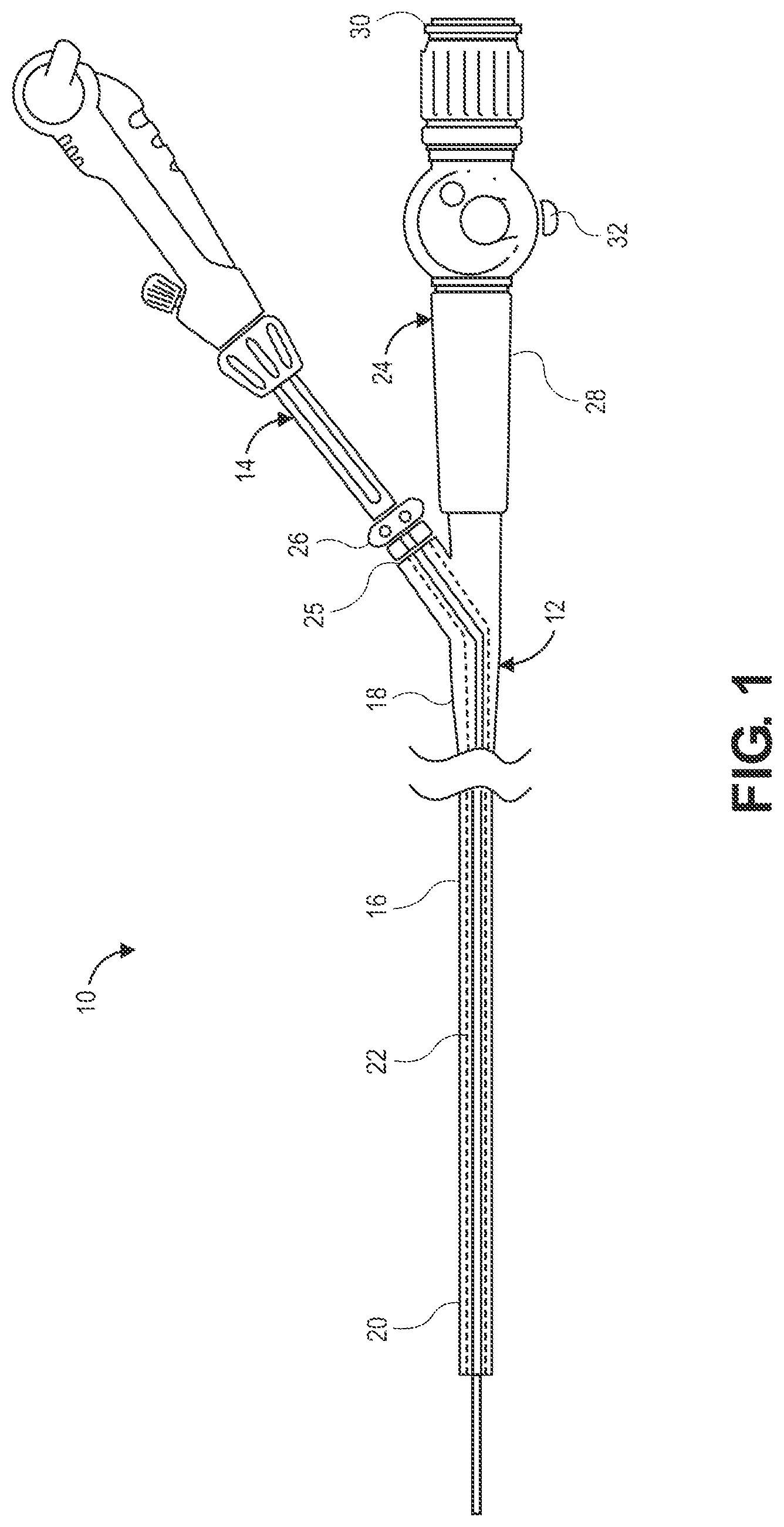 Patent US12551204 Figure 1 – Lung access device
