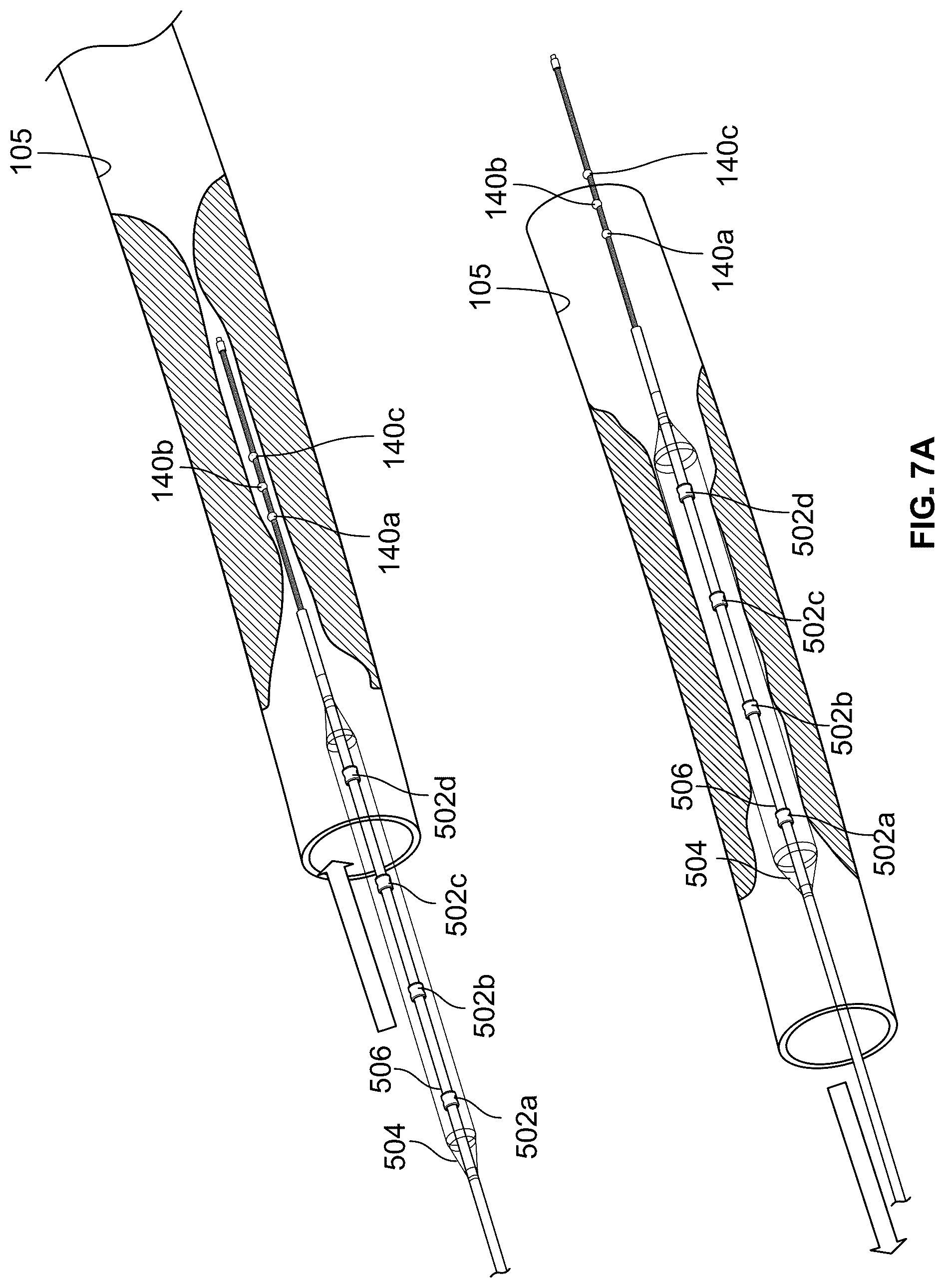 Patent US12551206 Figure 9 – Device with features for rotational atherectomy and lithotripsy