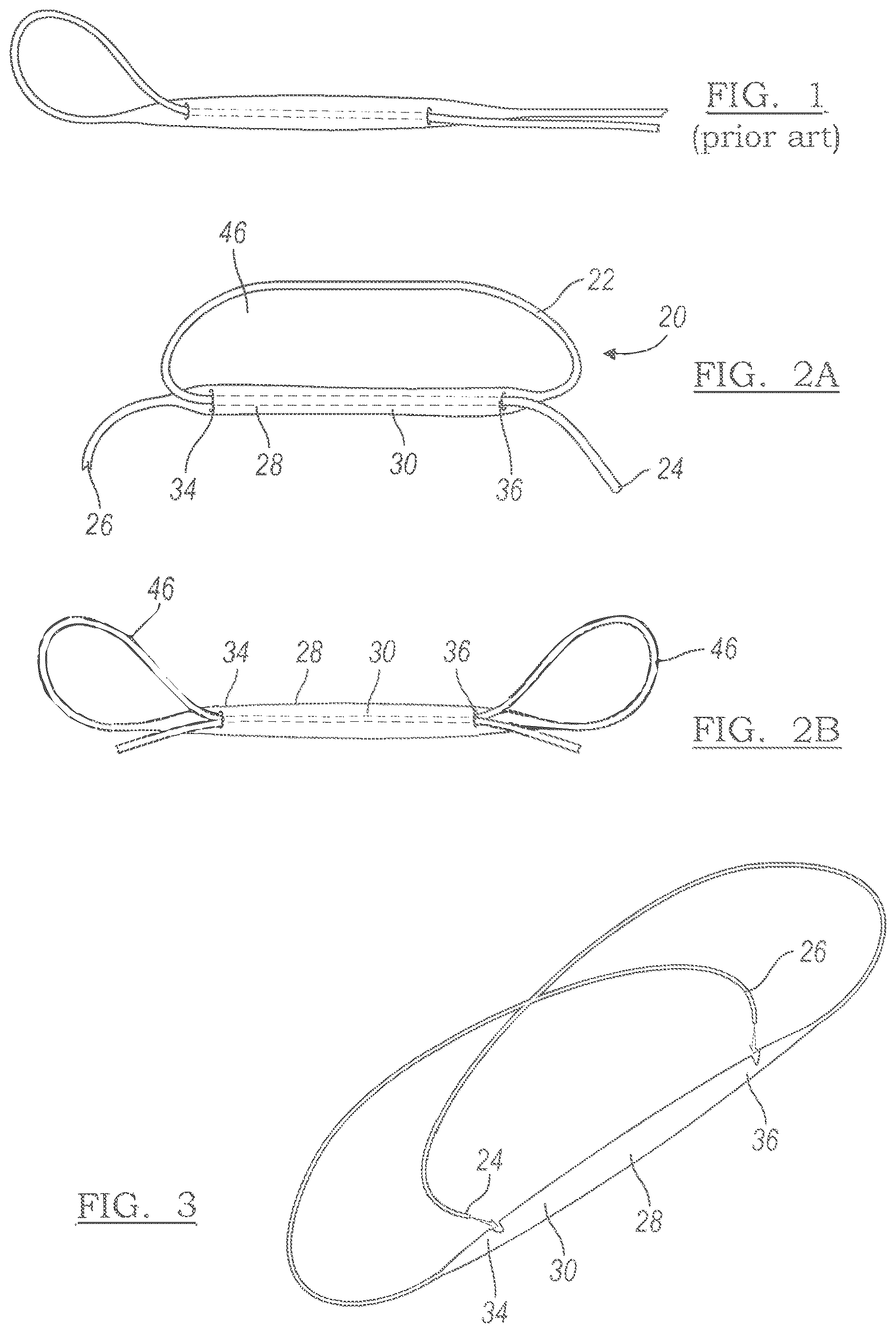 Patent US12551209 Figure 1 – Method and apparatus for coupling soft tissue to a bone
