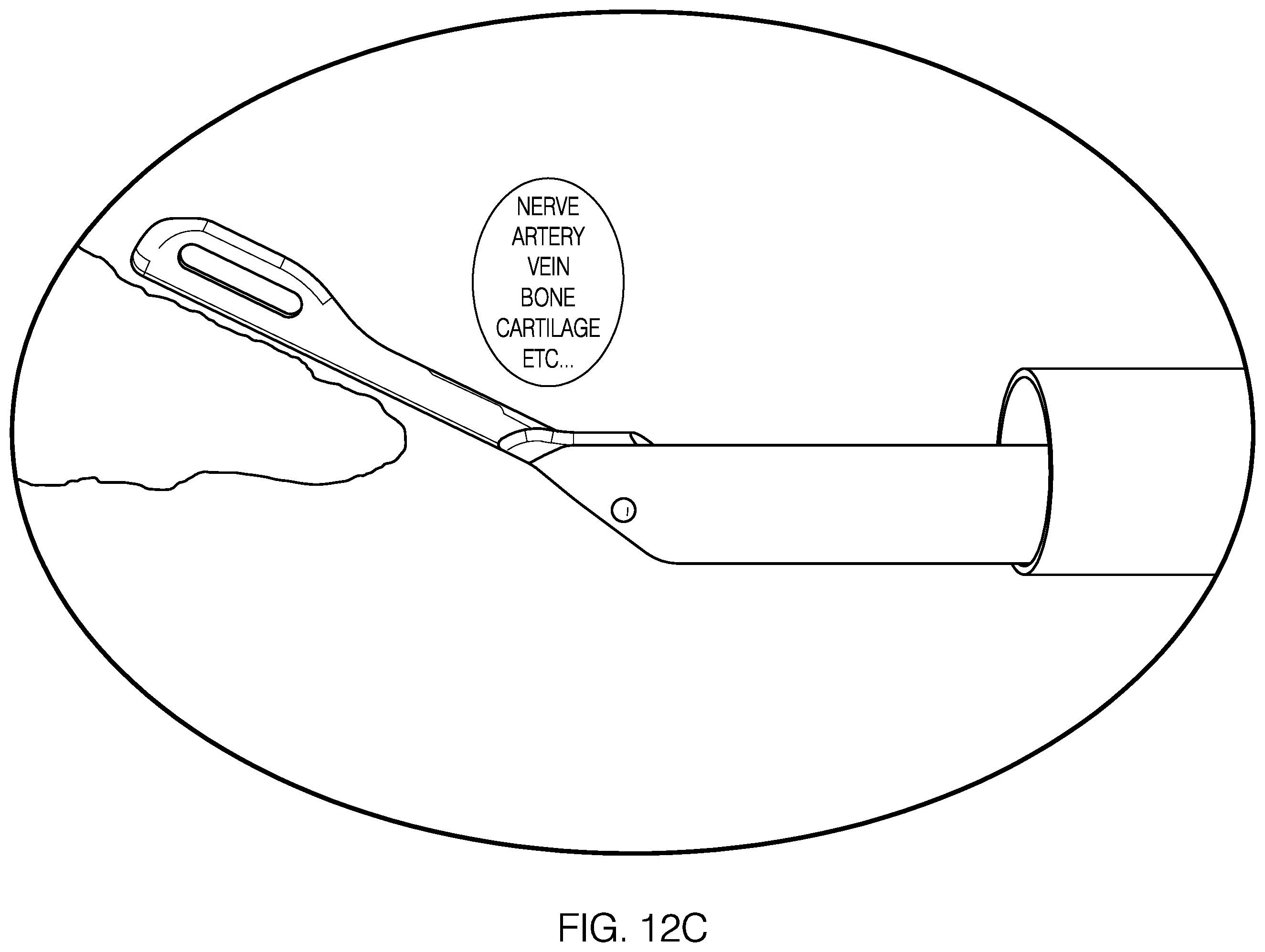 Patent US12551212 Figure 13 – Suture passer devices and methods