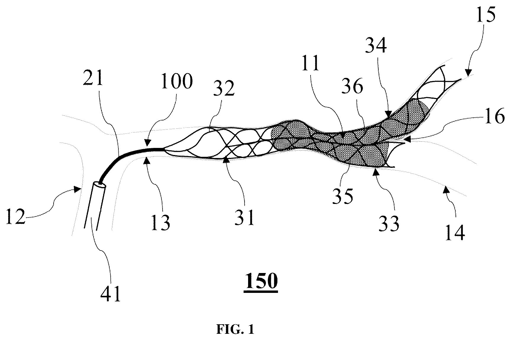 Patent US12551223 — Clot removal device — Figure 1