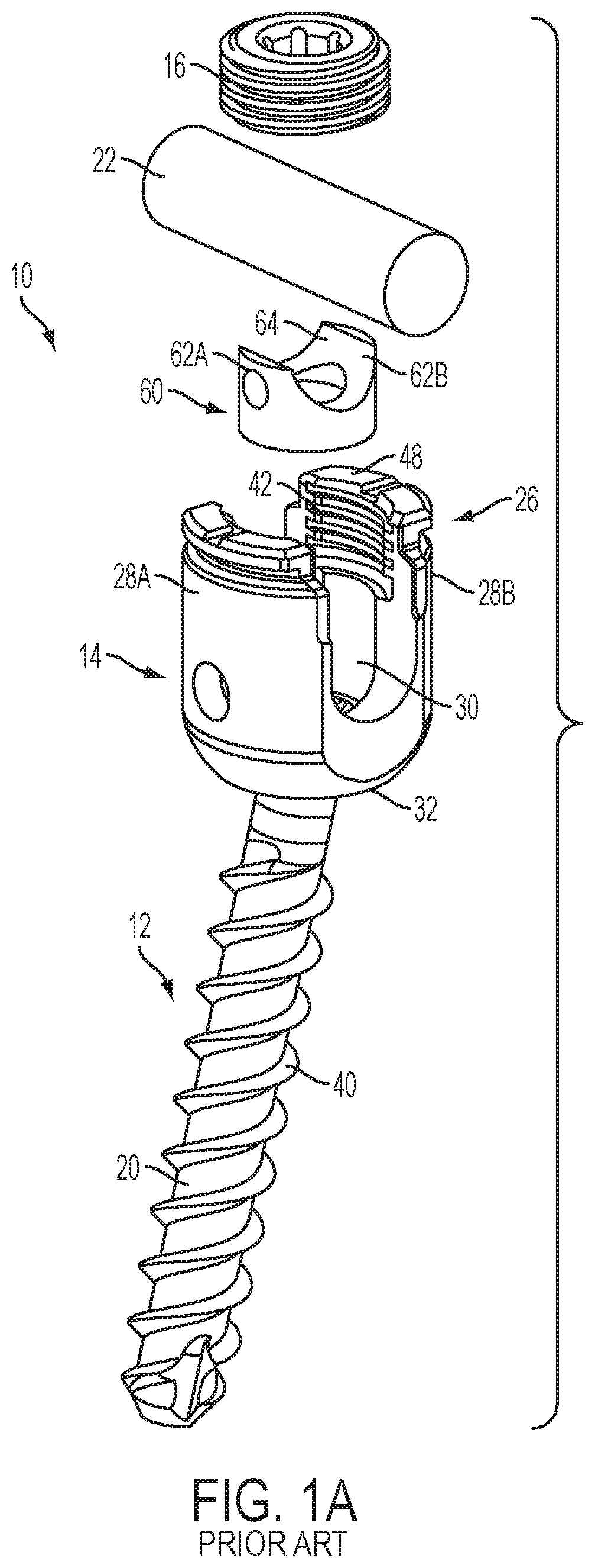 Patent US12551247 — Bone anchors and surgical instruments with integrated guide tips — Figure 1