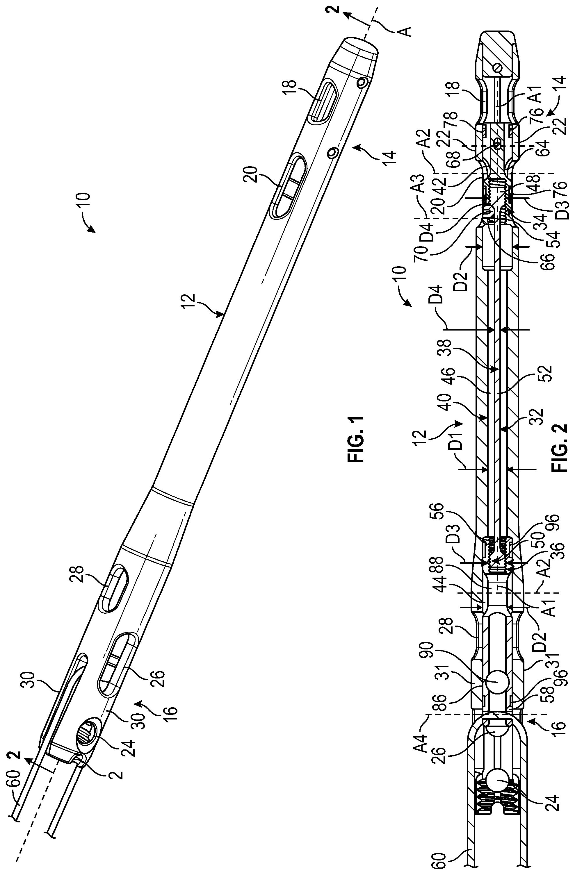 Patent US12551248 — Surgical devices for applying compression within or across joints — Figure 1
