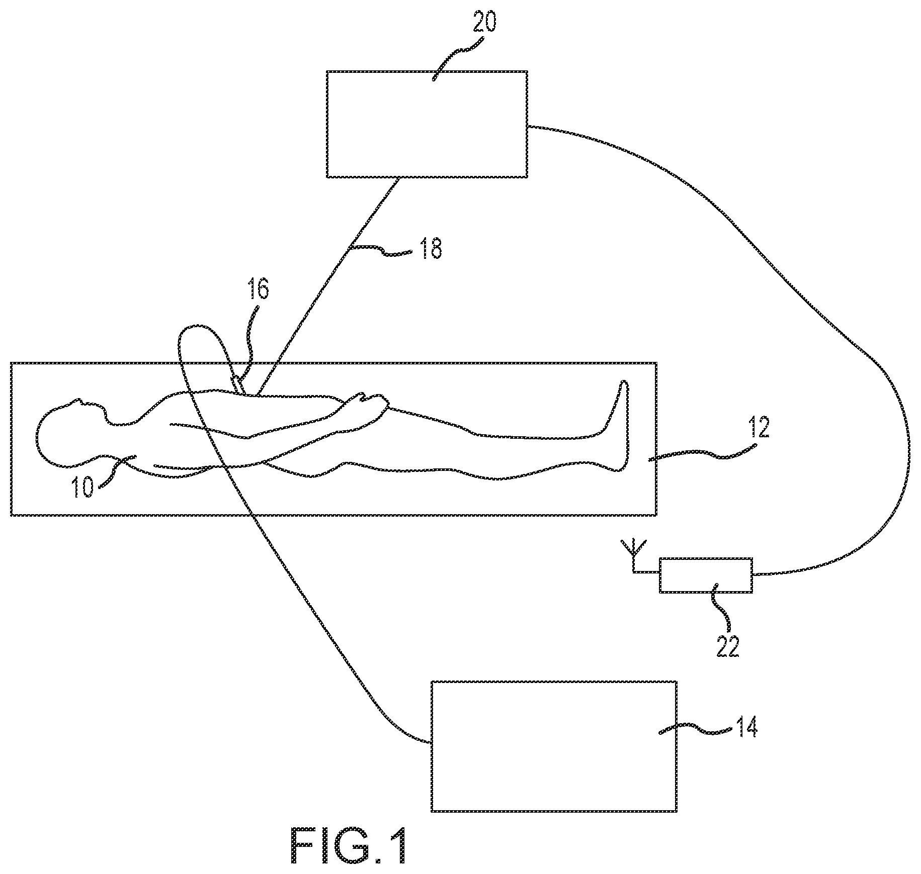 Patent US12551263 Figure 1 – System and apparatus for automatic activation using radio frequency sensor
