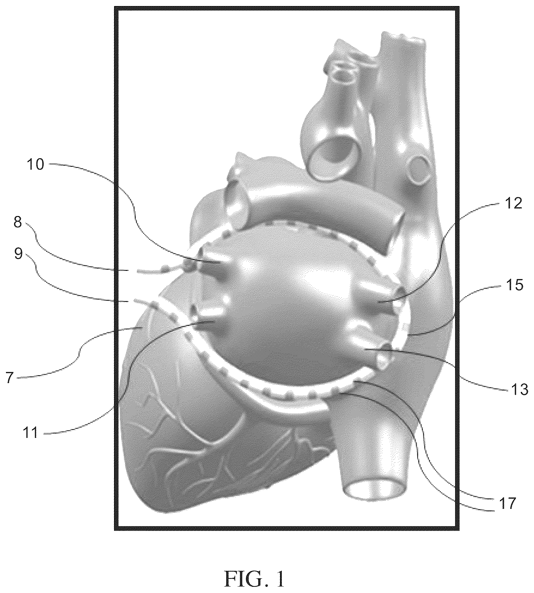 Patent US12551274 — Methods and apparatus for selective tissue ablation — Figure 1