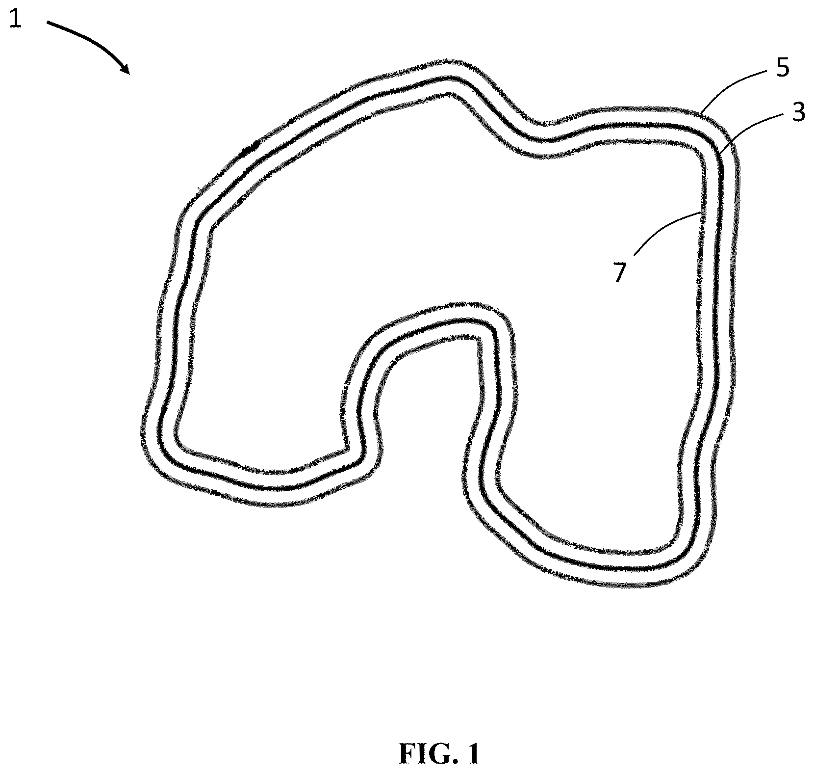 Patent US12551284 — Implant design optimization for geometric uncertainty — Figure 1