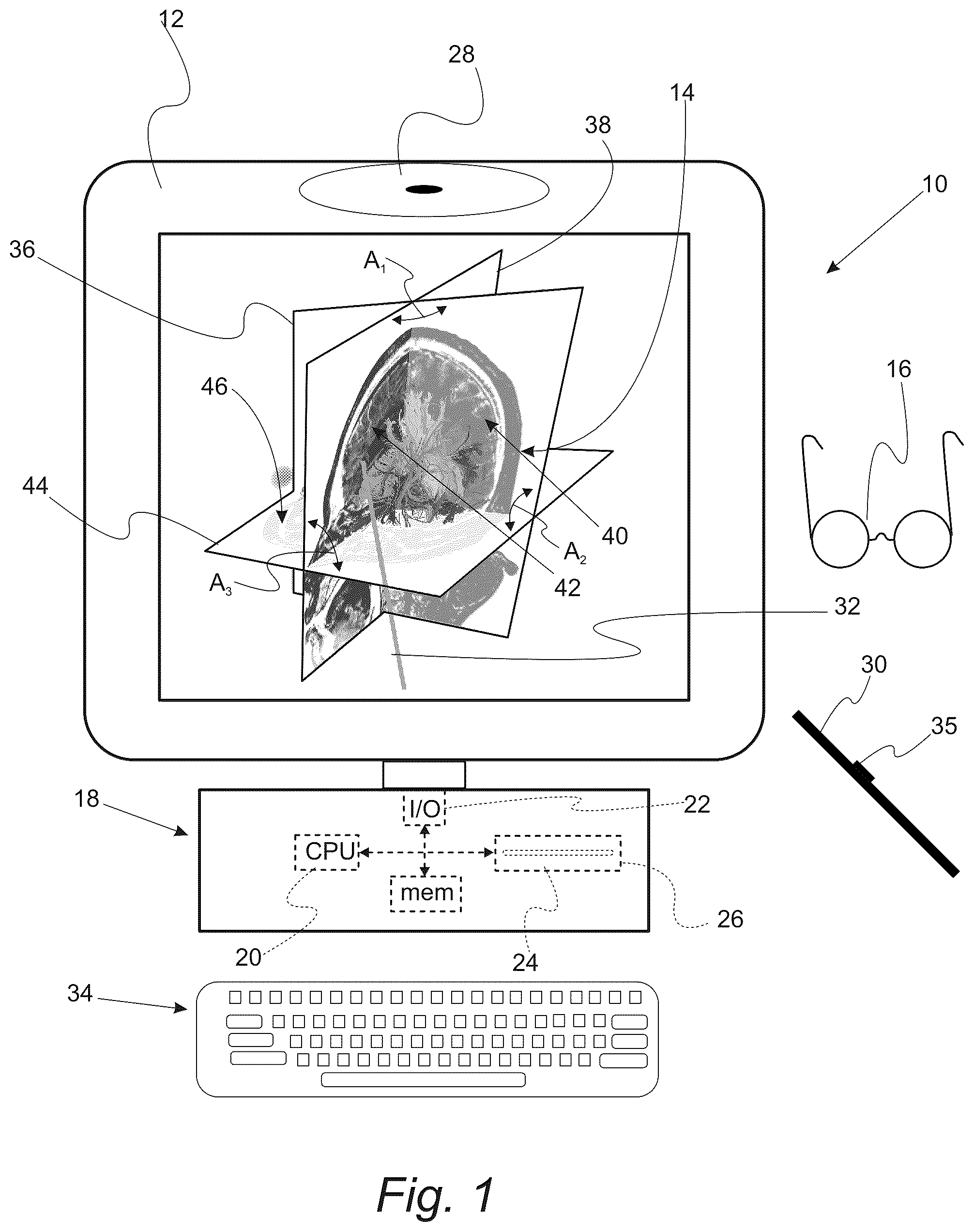 Patent US12551286 Figure 1 – Surgical planning, surgical navigation and imaging system