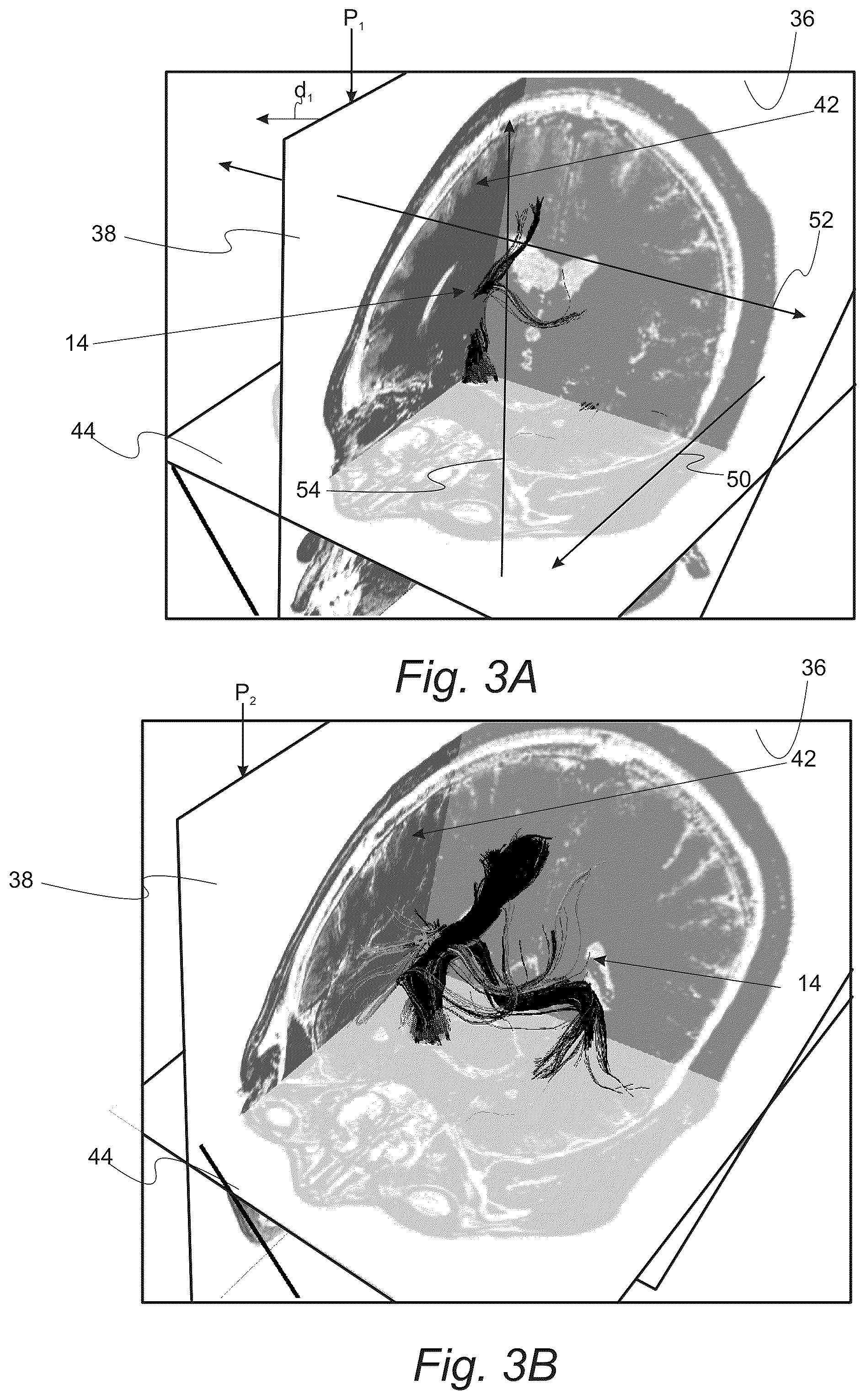 Patent US12551286 Figure 3 – Surgical planning, surgical navigation and imaging system