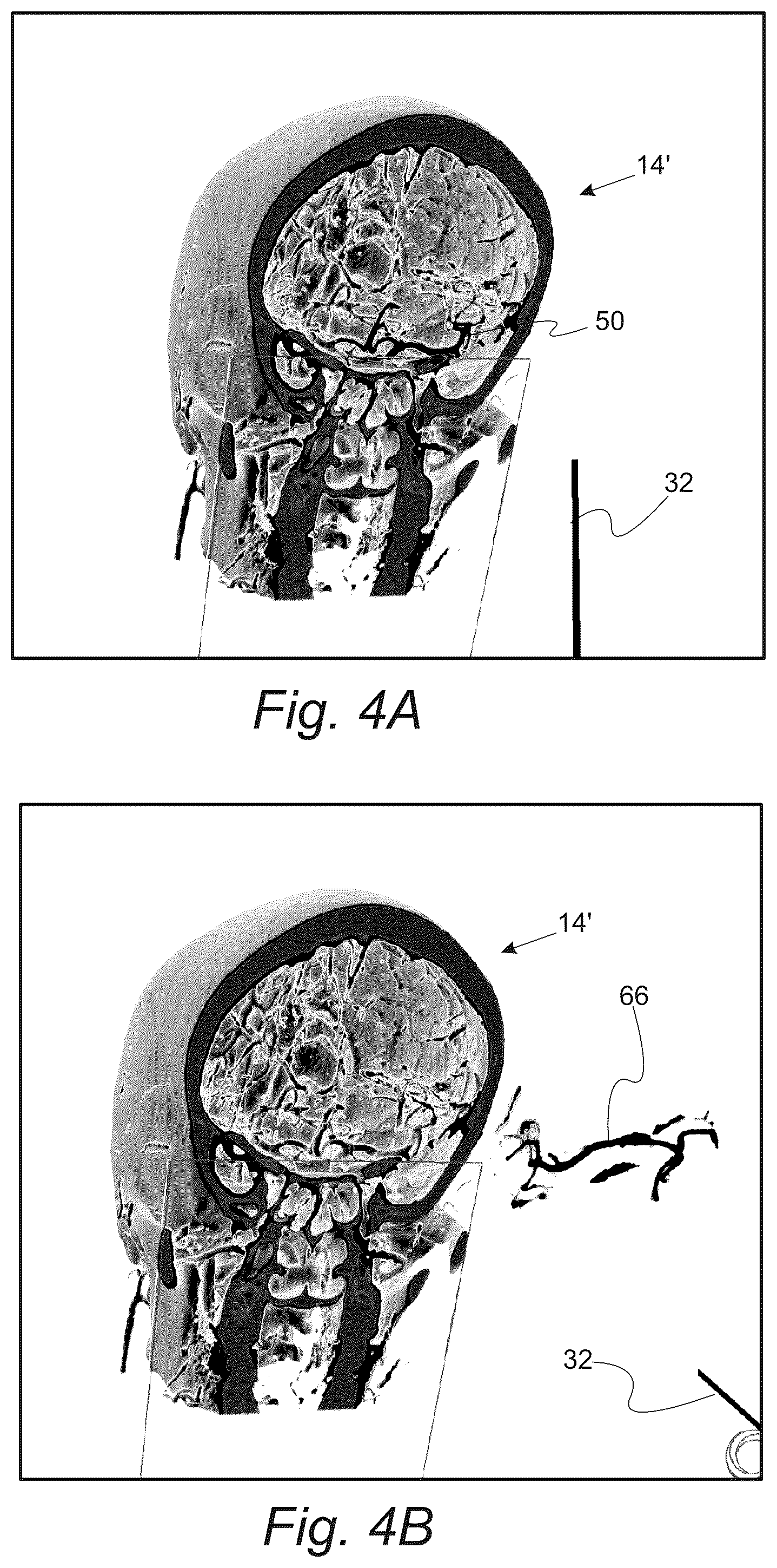 Patent US12551286 Figure 5 – Surgical planning, surgical navigation and imaging system