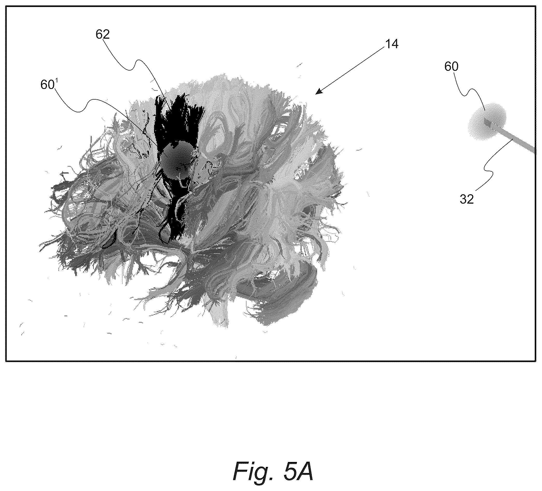 Patent US12551286 Figure 6 – Surgical planning, surgical navigation and imaging system