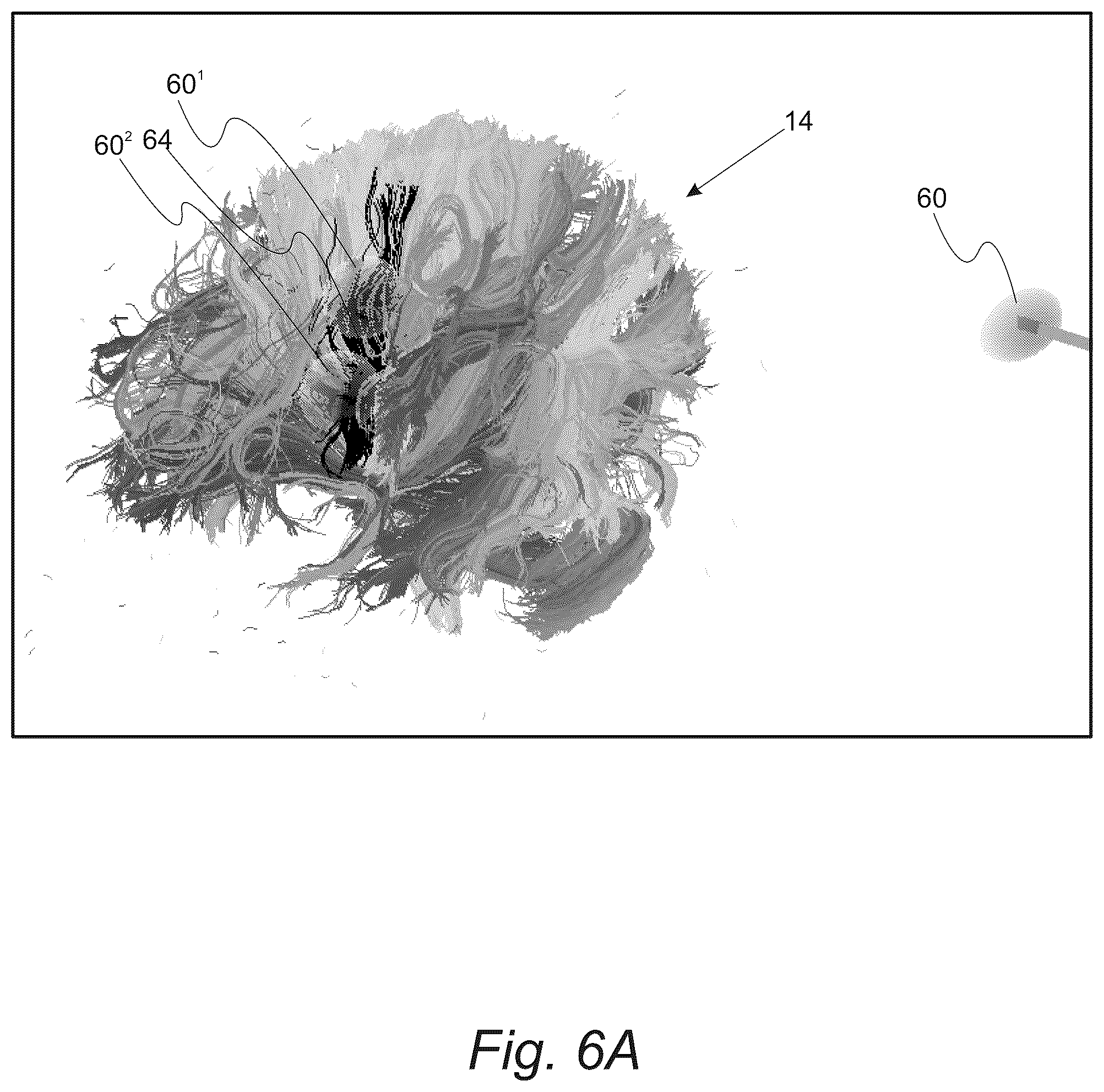 Patent US12551286 Figure 8 – Surgical planning, surgical navigation and imaging system