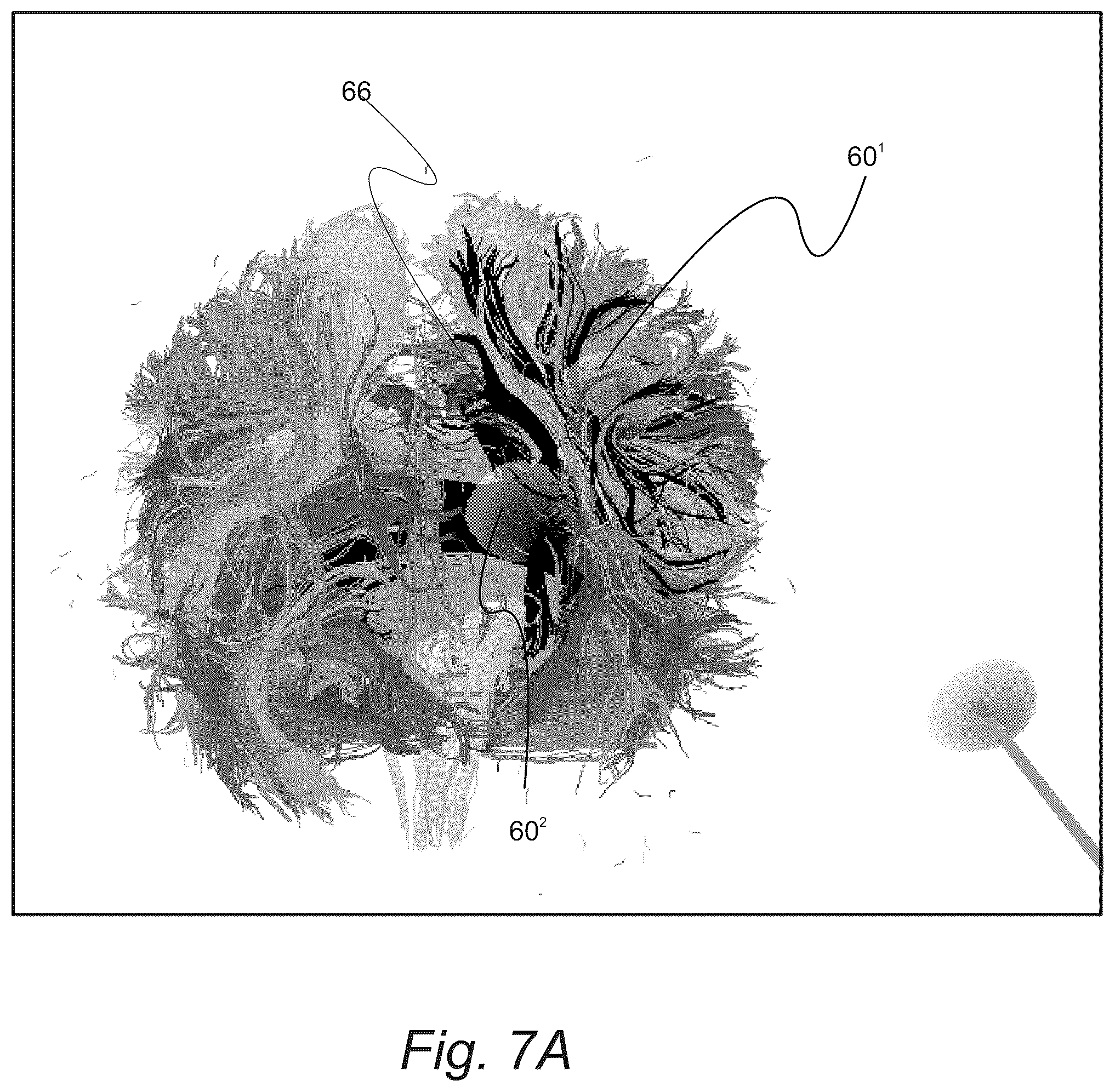 Patent US12551286 Figure 10 – Surgical planning, surgical navigation and imaging system