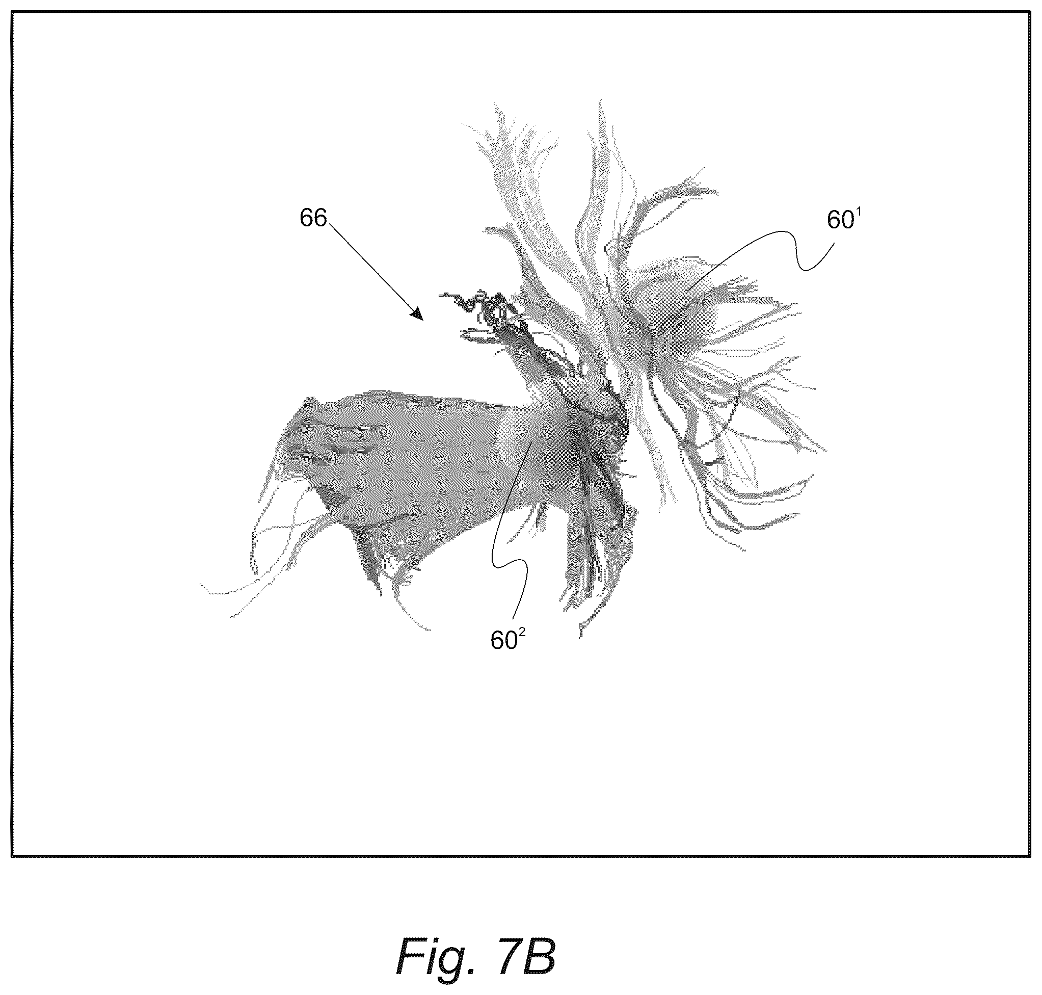 Patent US12551286 Figure 11 – Surgical planning, surgical navigation and imaging system