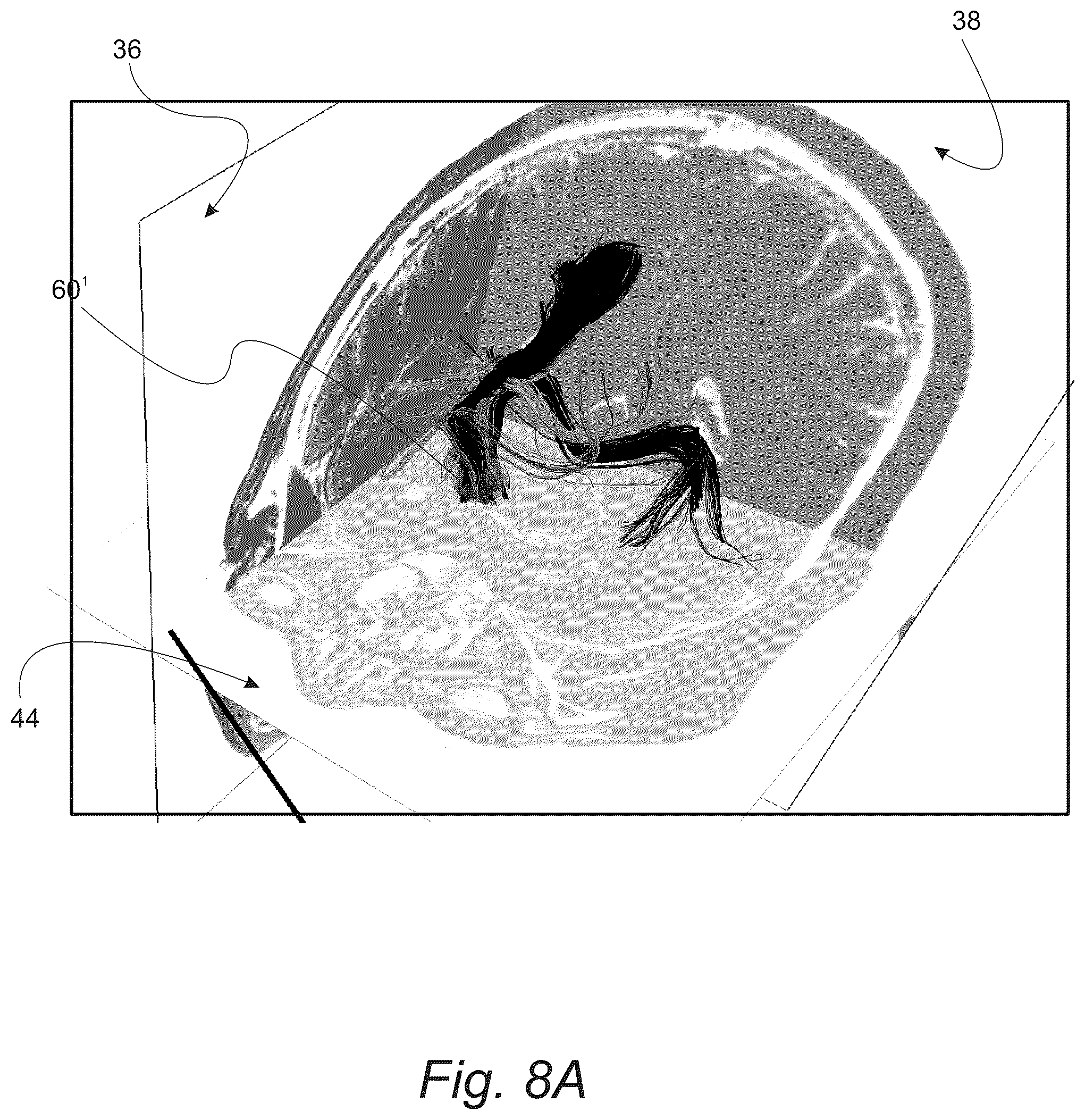 Patent US12551286 Figure 13 – Surgical planning, surgical navigation and imaging system