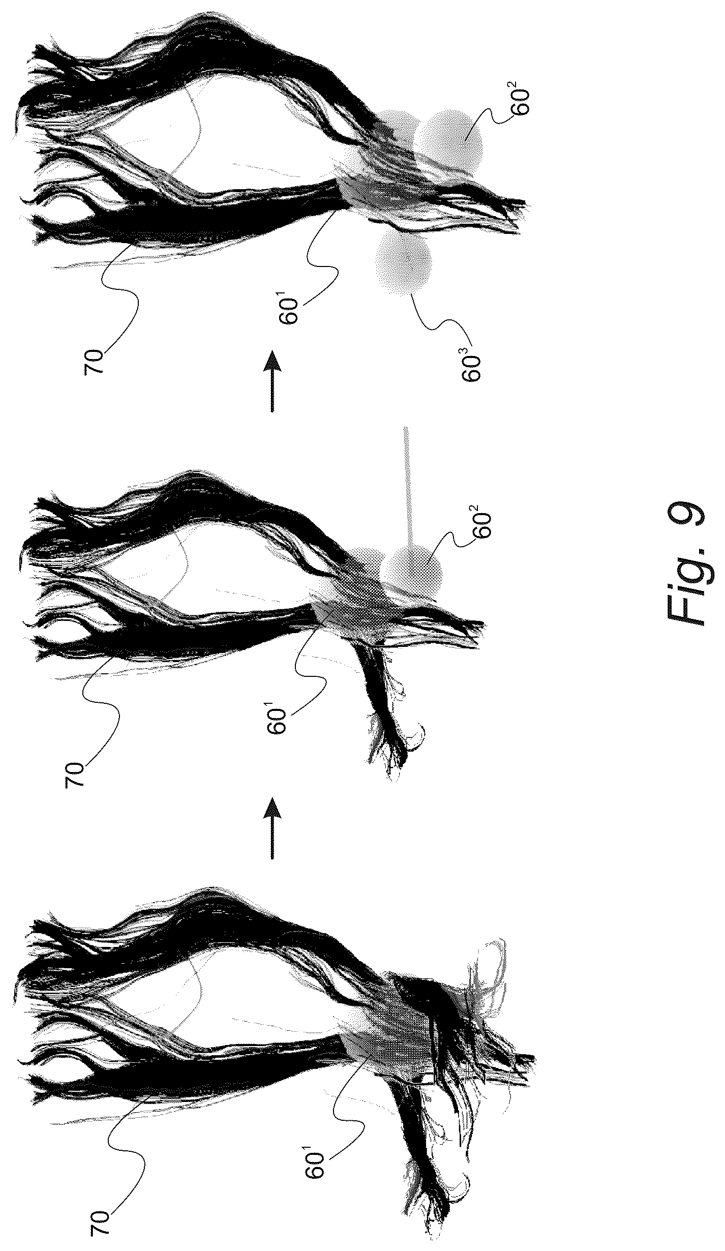 Patent US12551286 Figure 15 – Surgical planning, surgical navigation and imaging system