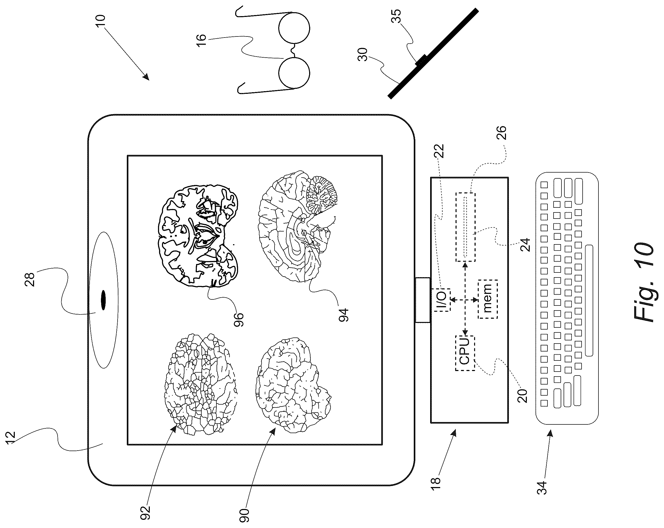 Patent US12551286 Figure 16 – Surgical planning, surgical navigation and imaging system