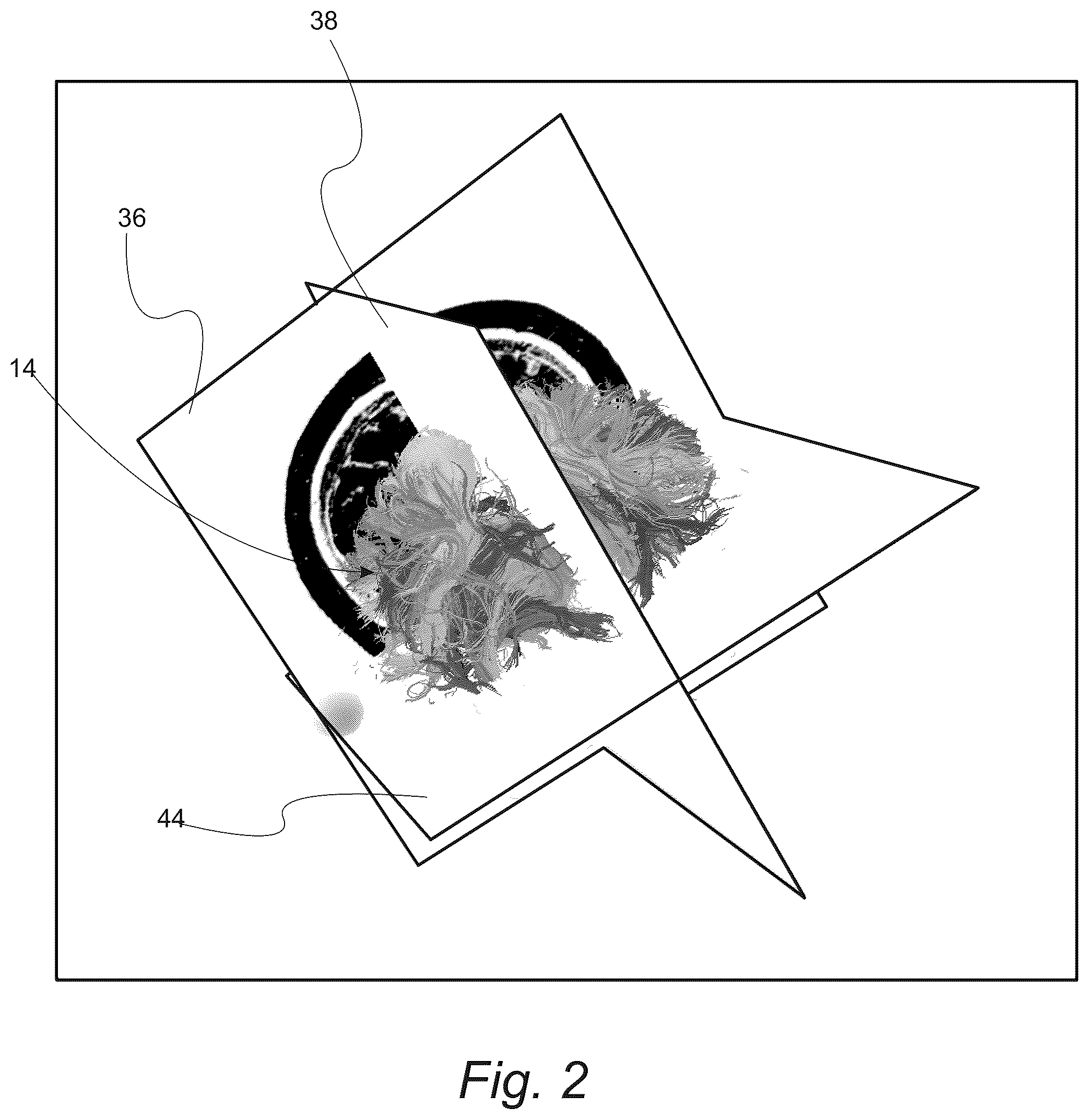 Patent US12551287 Figure 2 – Surgical planning, surgical navigation and imaging system