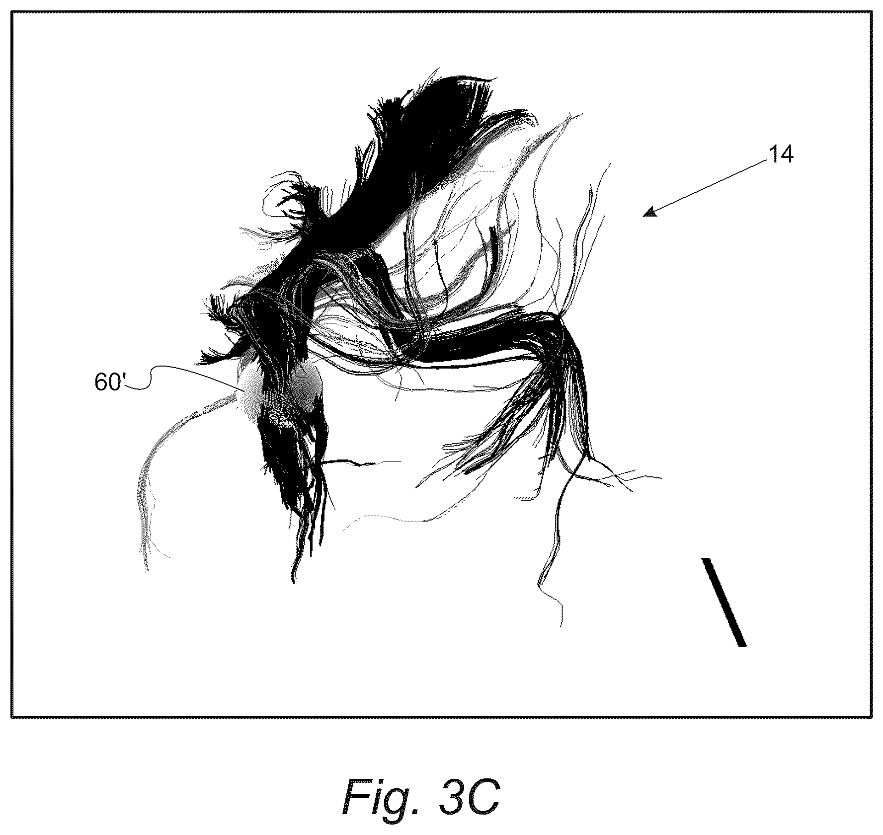 Patent US12551287 Figure 4 – Surgical planning, surgical navigation and imaging system