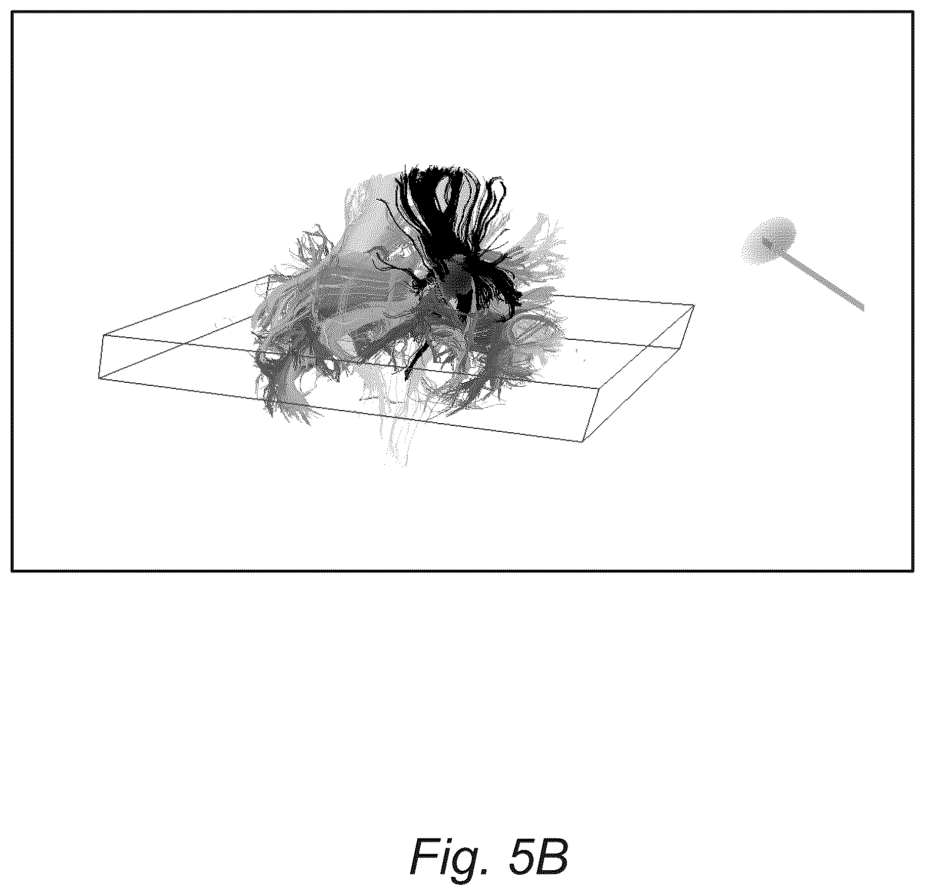 Patent US12551287 Figure 7 – Surgical planning, surgical navigation and imaging system