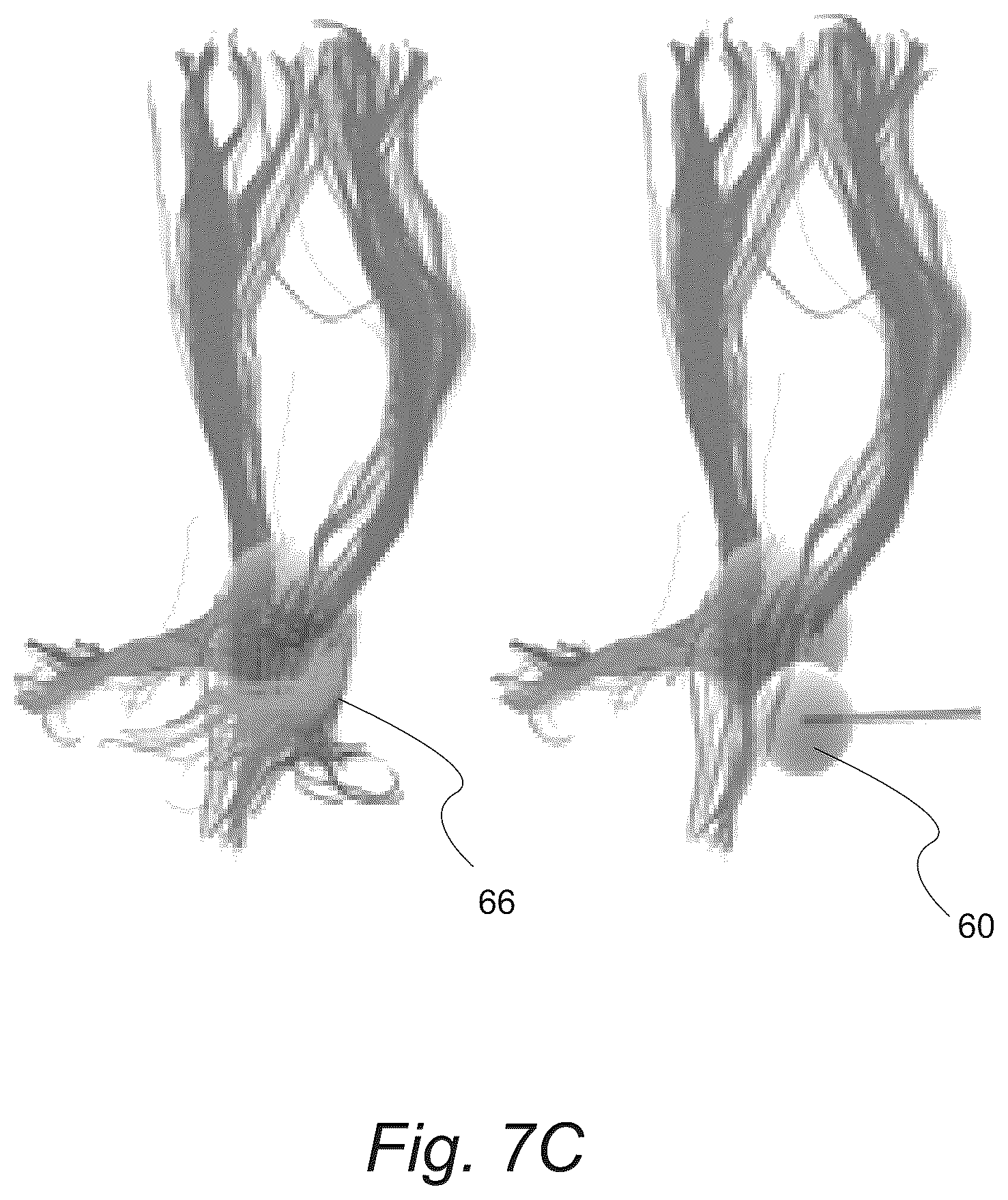 Patent US12551287 Figure 12 – Surgical planning, surgical navigation and imaging system