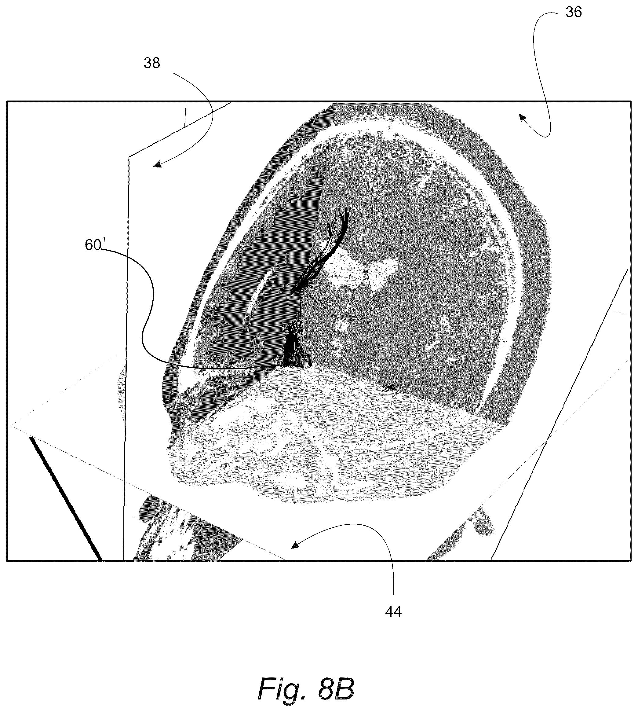 Patent US12551287 Figure 14 – Surgical planning, surgical navigation and imaging system