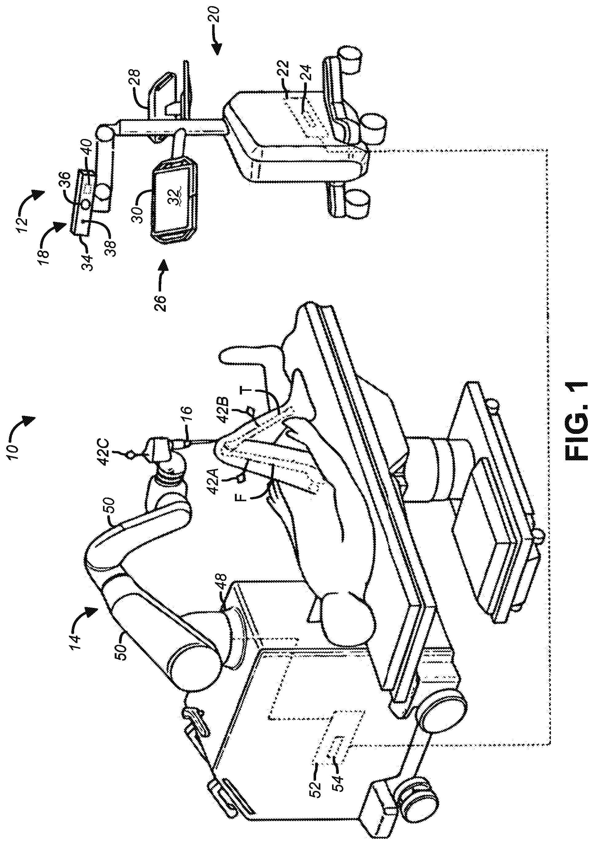 Patent US12551289 — Tracker-based surgical navigation — Figure 1