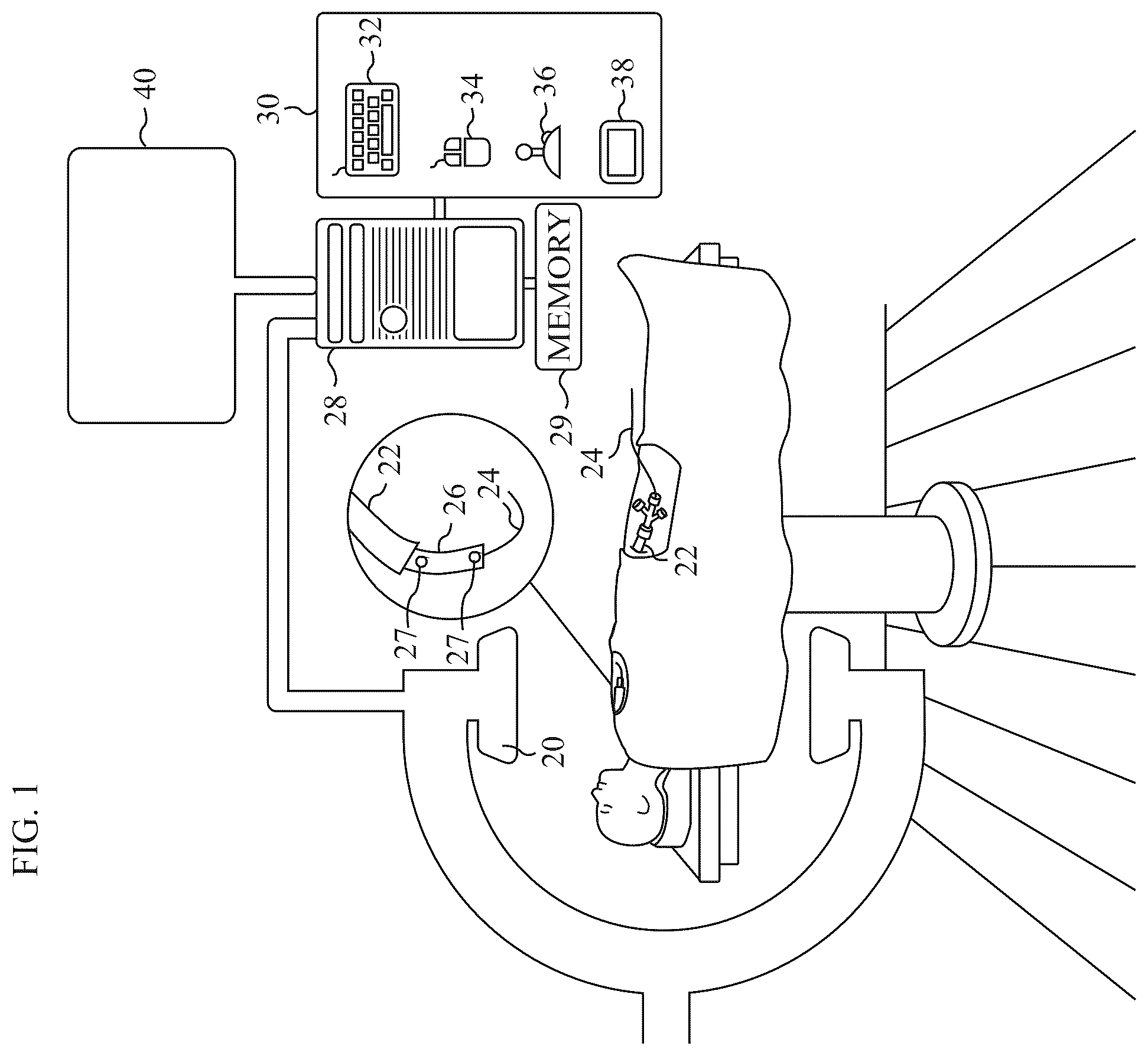 Patent US12551296 — Estimating the endoluminal path of an endoluminal device along a lumen — Figure 1
