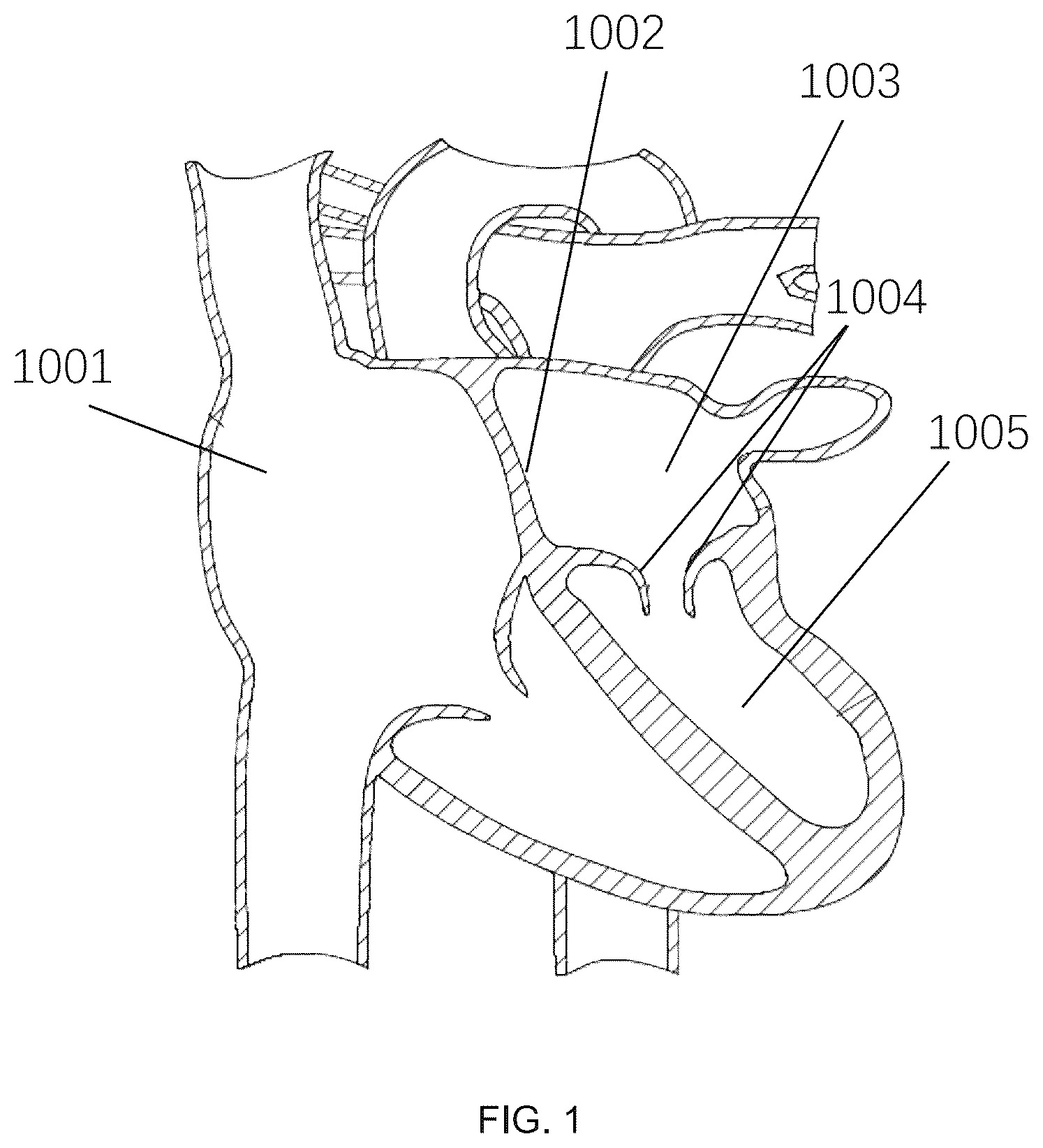 Patent US12551305 — Control method and associated apparatus for surgical assistance system — Figure 1