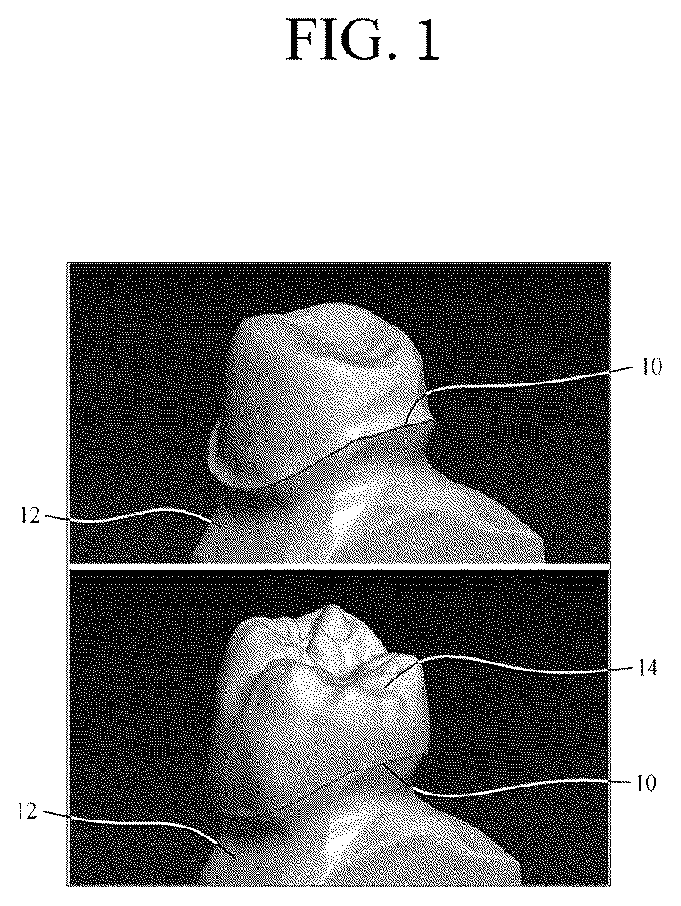 Patent US12551320 — Method for selecting margin line point, and dental cad device therefor — Figure 1