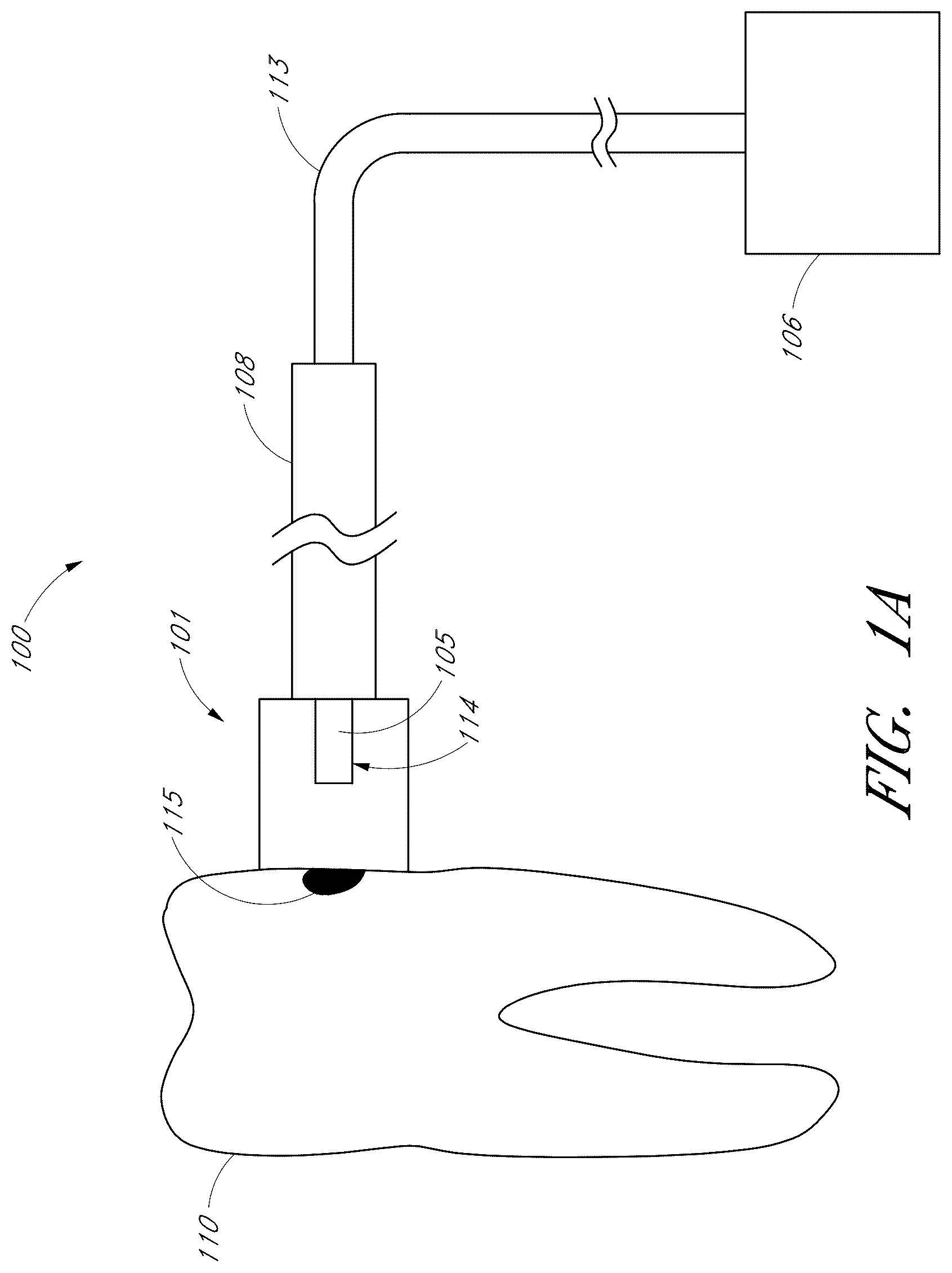 Patent US12551322 — Apparatus and methods for cleaning teeth — Figure 1