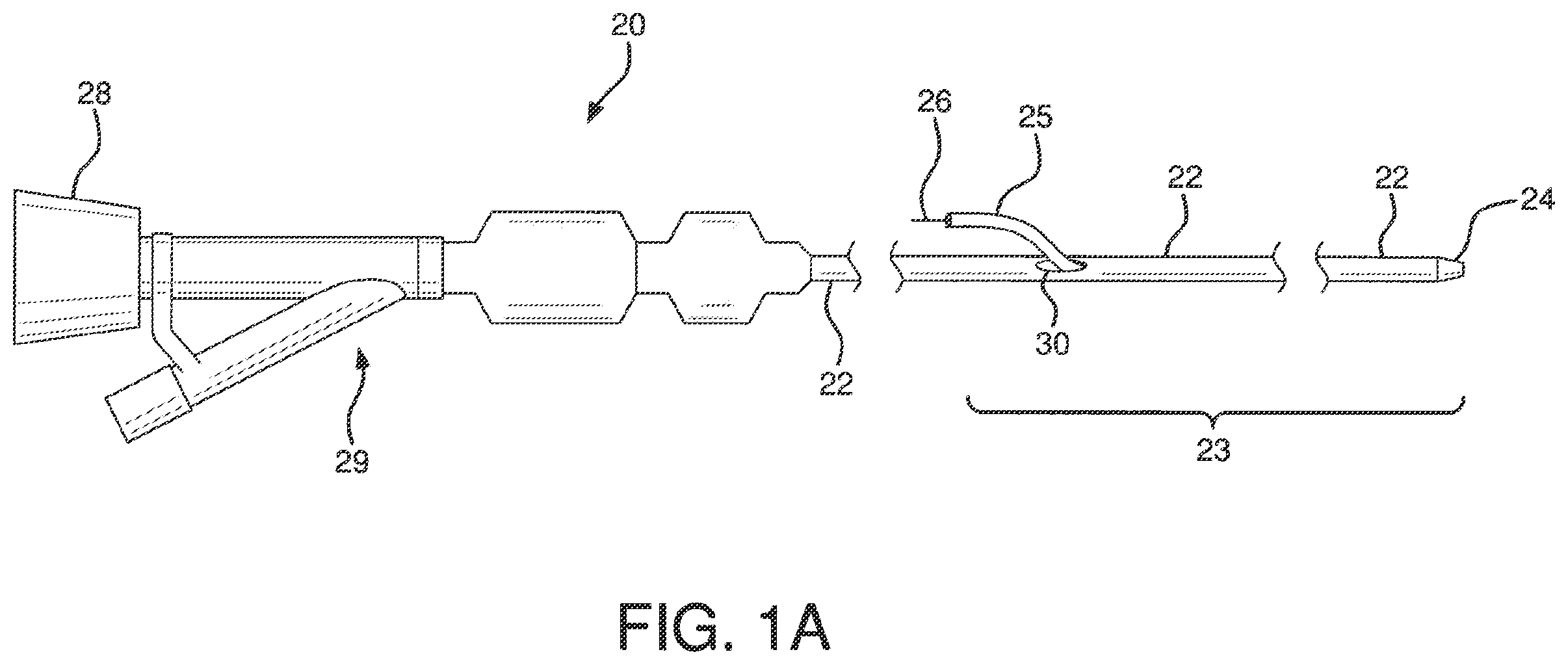 Patent US12551326 — Retrieval catheter — Figure 1