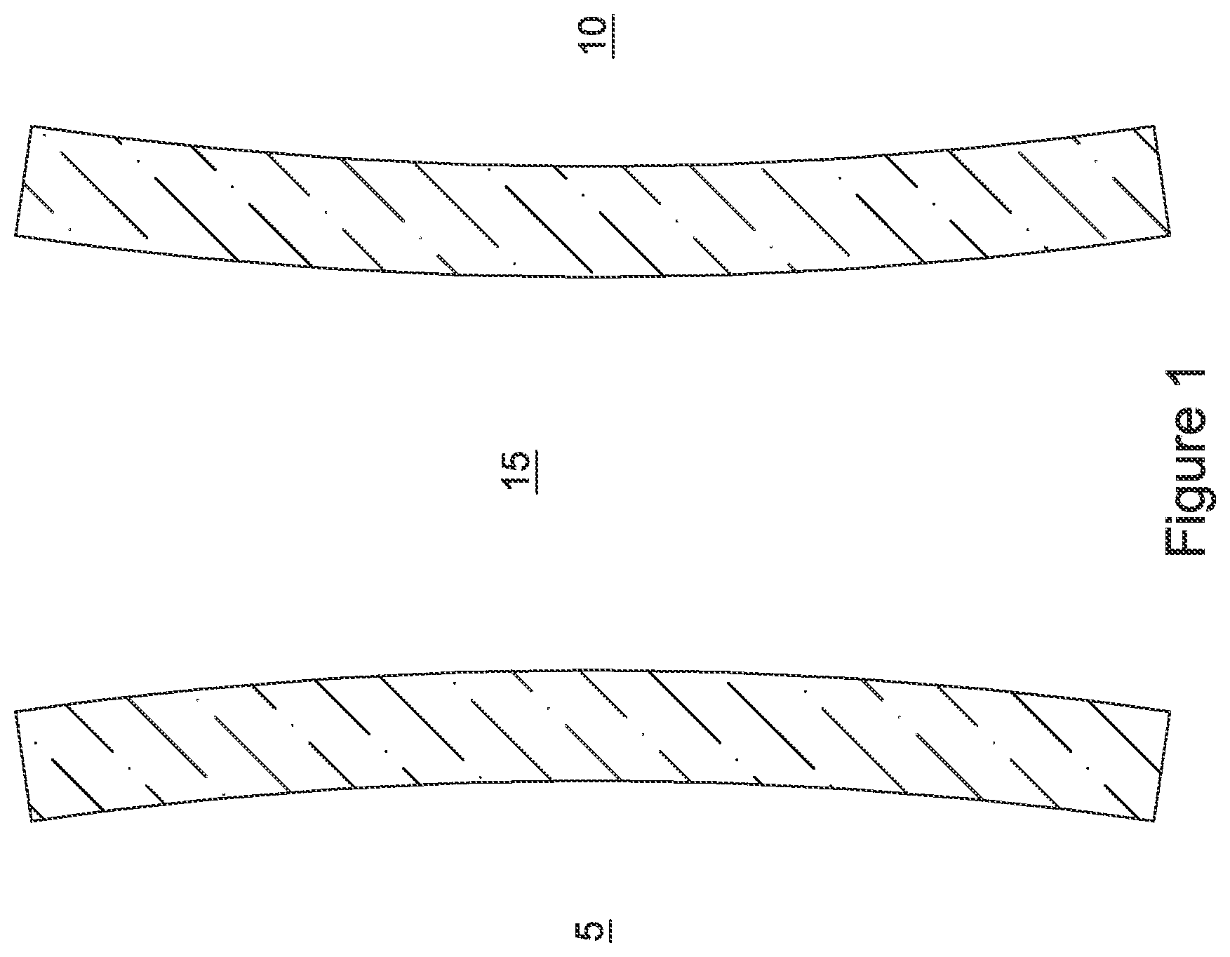 Patent US12551328 — Device for anastomotic bypass — Figure 1