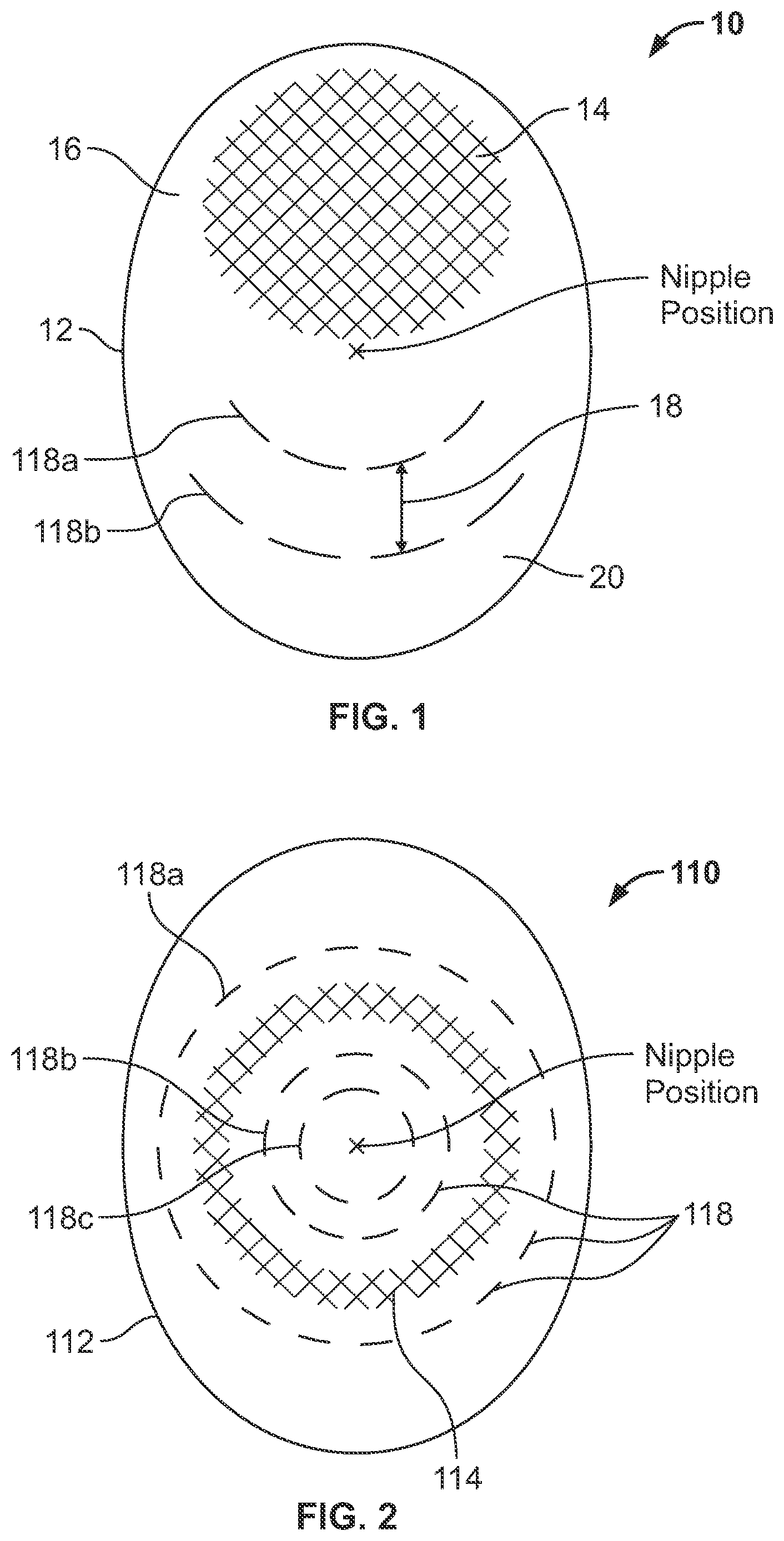Patent US12551331 — Diversified grafts having heterogenous features and methods for making and using same — Figure 1